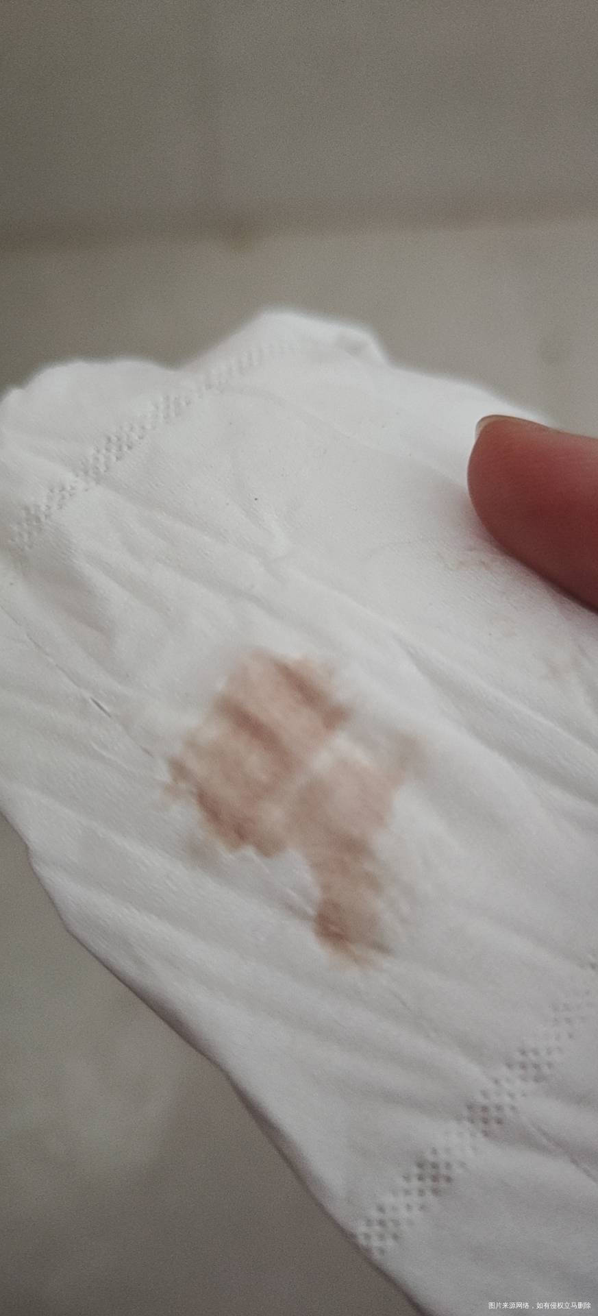 1月17日移植5天的冻囊胚一直有炎症1月29