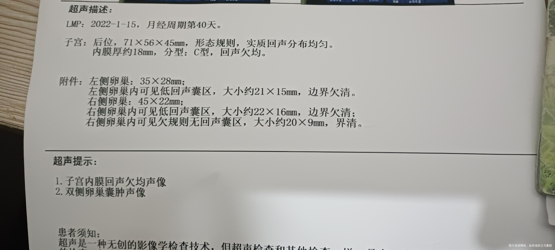 多囊月经第5天吃了氯米芬排卵期监测排卵月经推