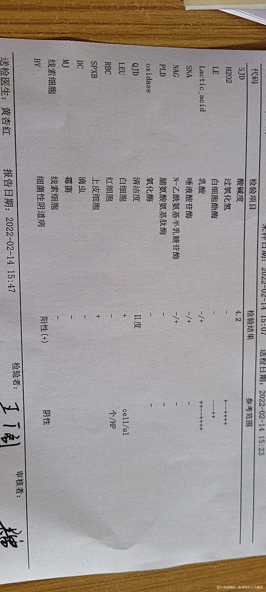 下面有异味帮我看看白带正常吗
