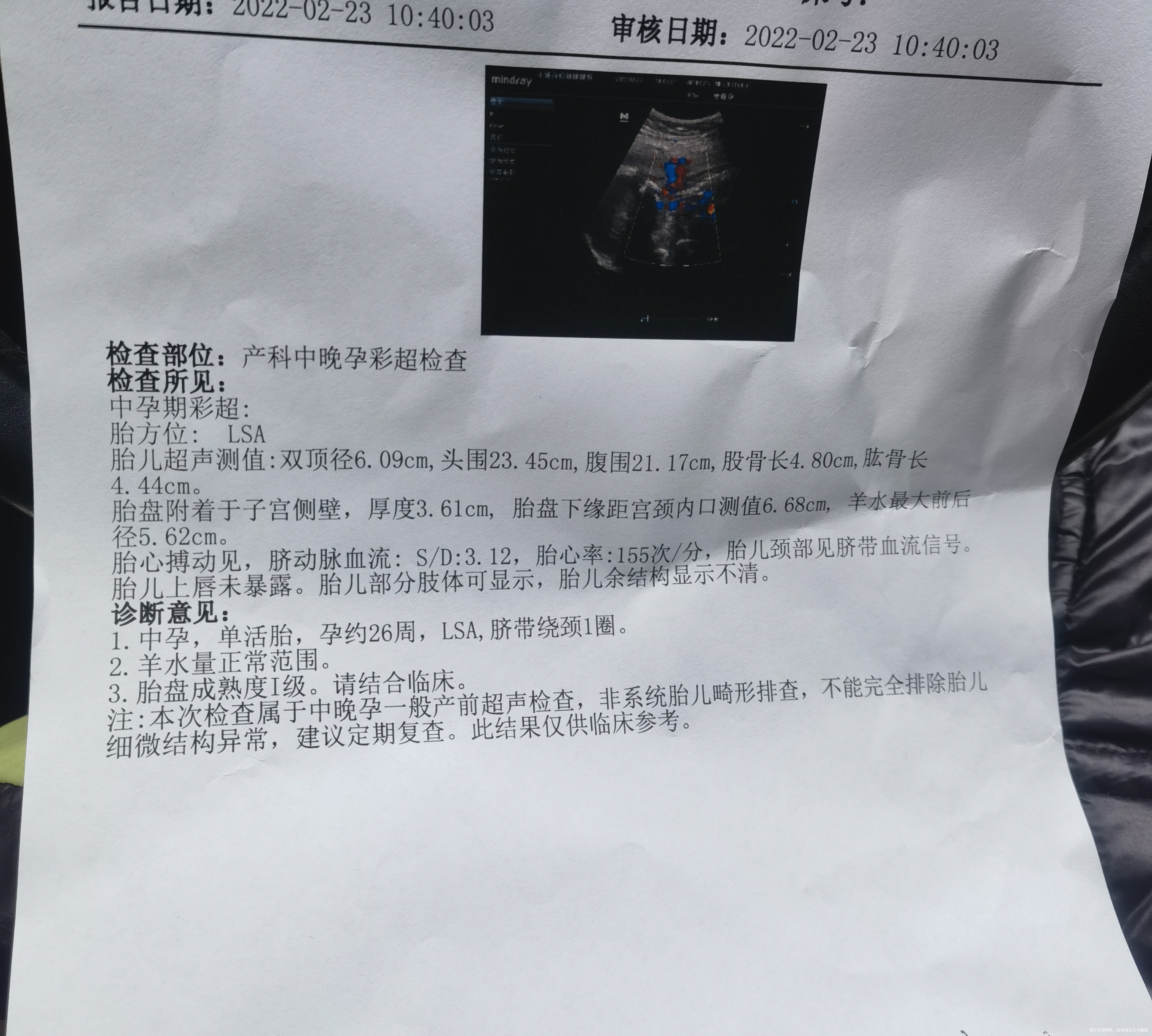 请问B超单上胎儿发育指标是符合孕26周的吗