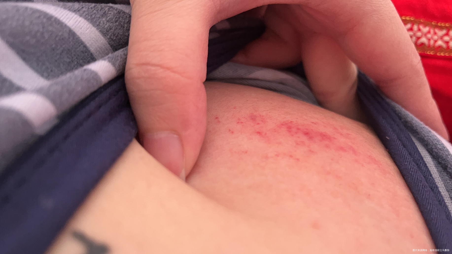 怀孕四个月胸特别痒痒的受不了