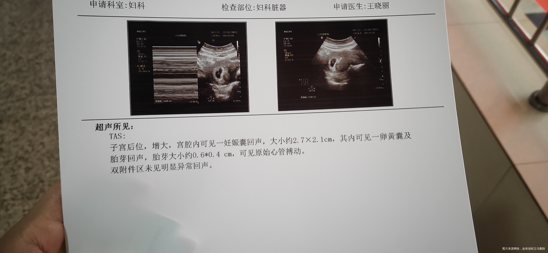 孕七周已有胎心胎芽但孕酮值低该怎么办