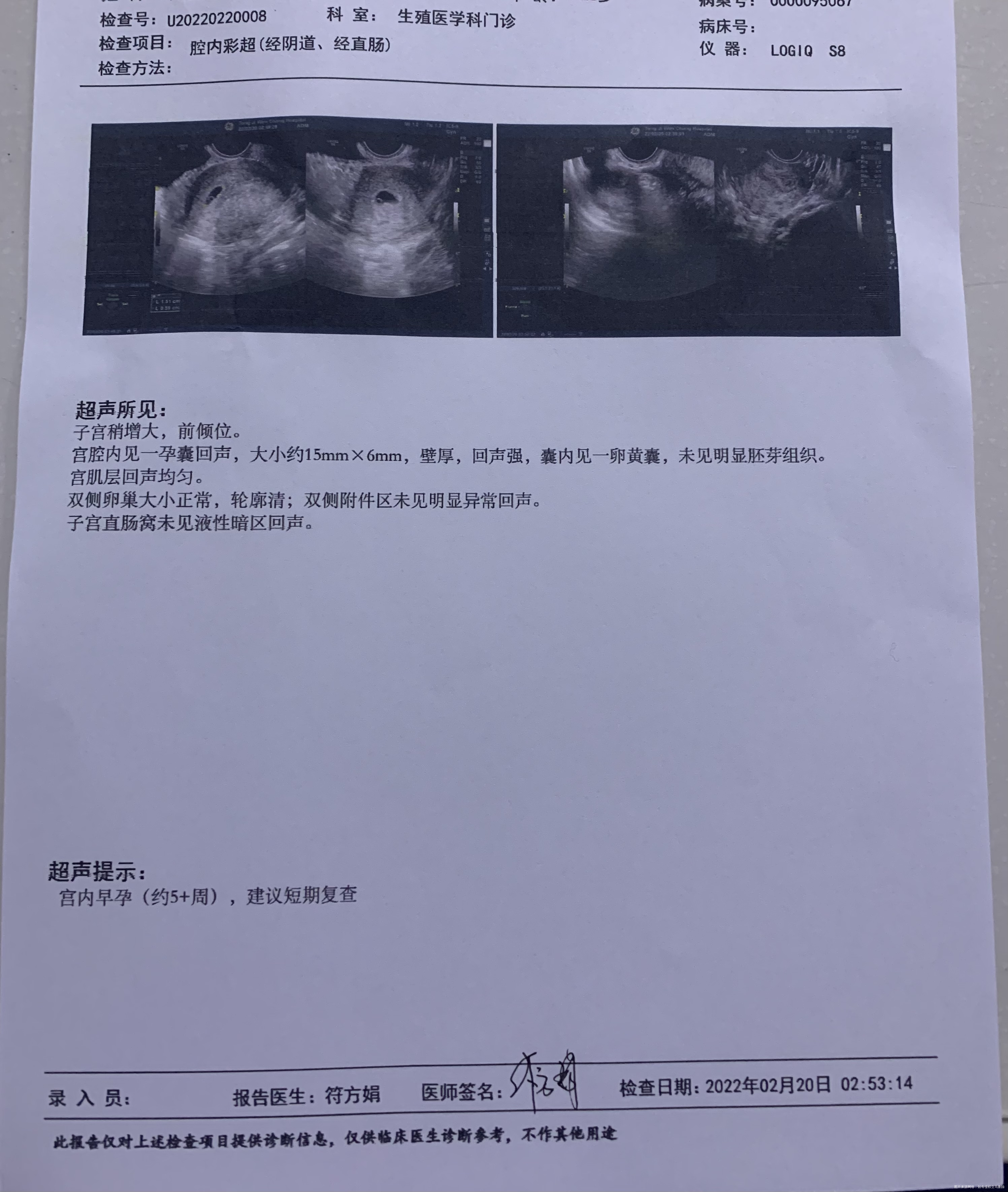 1月8号末次月经24号排卵今天流褐色分泌物做