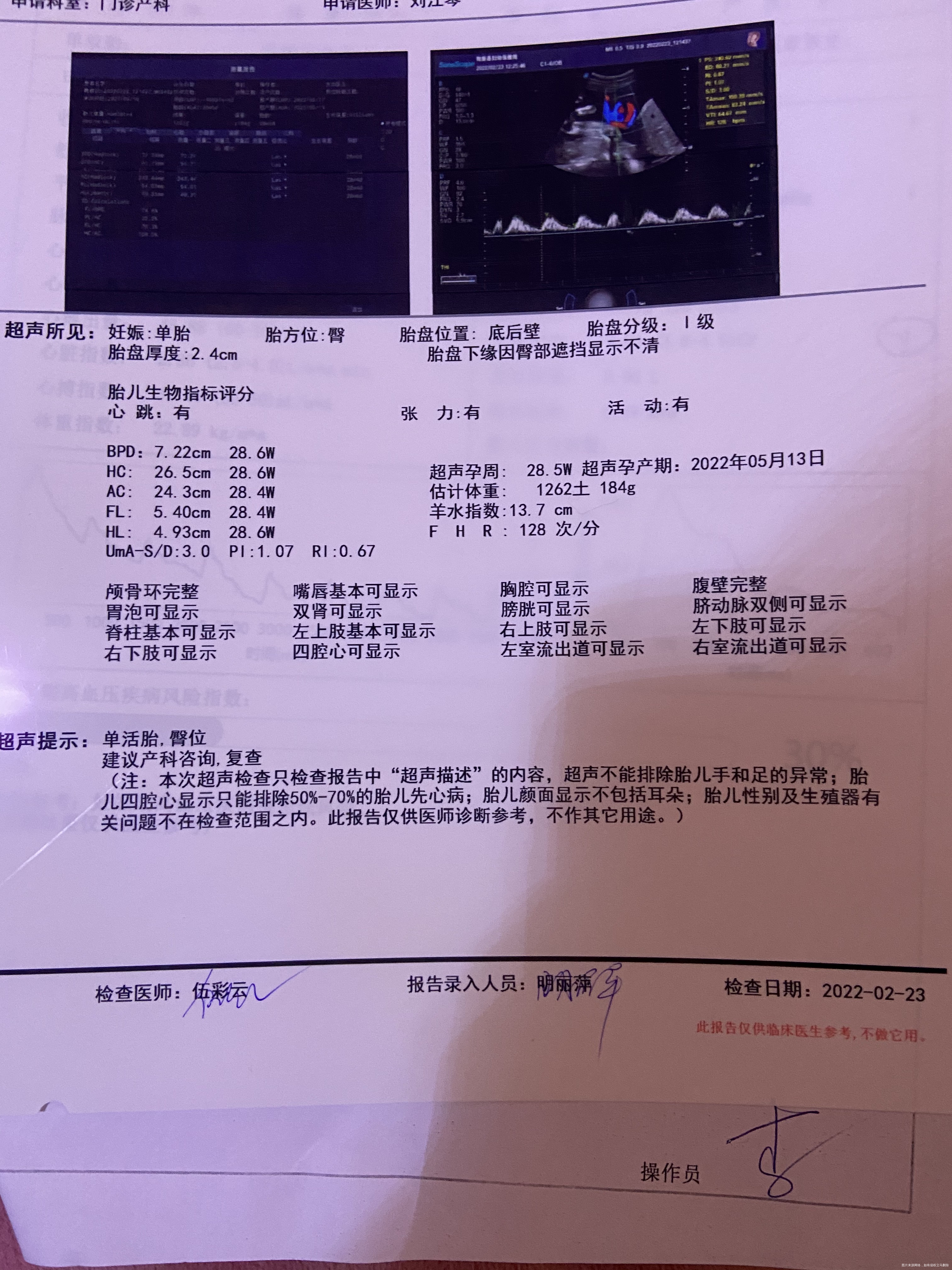 麻烦医生看看宝宝发育情况谢谢