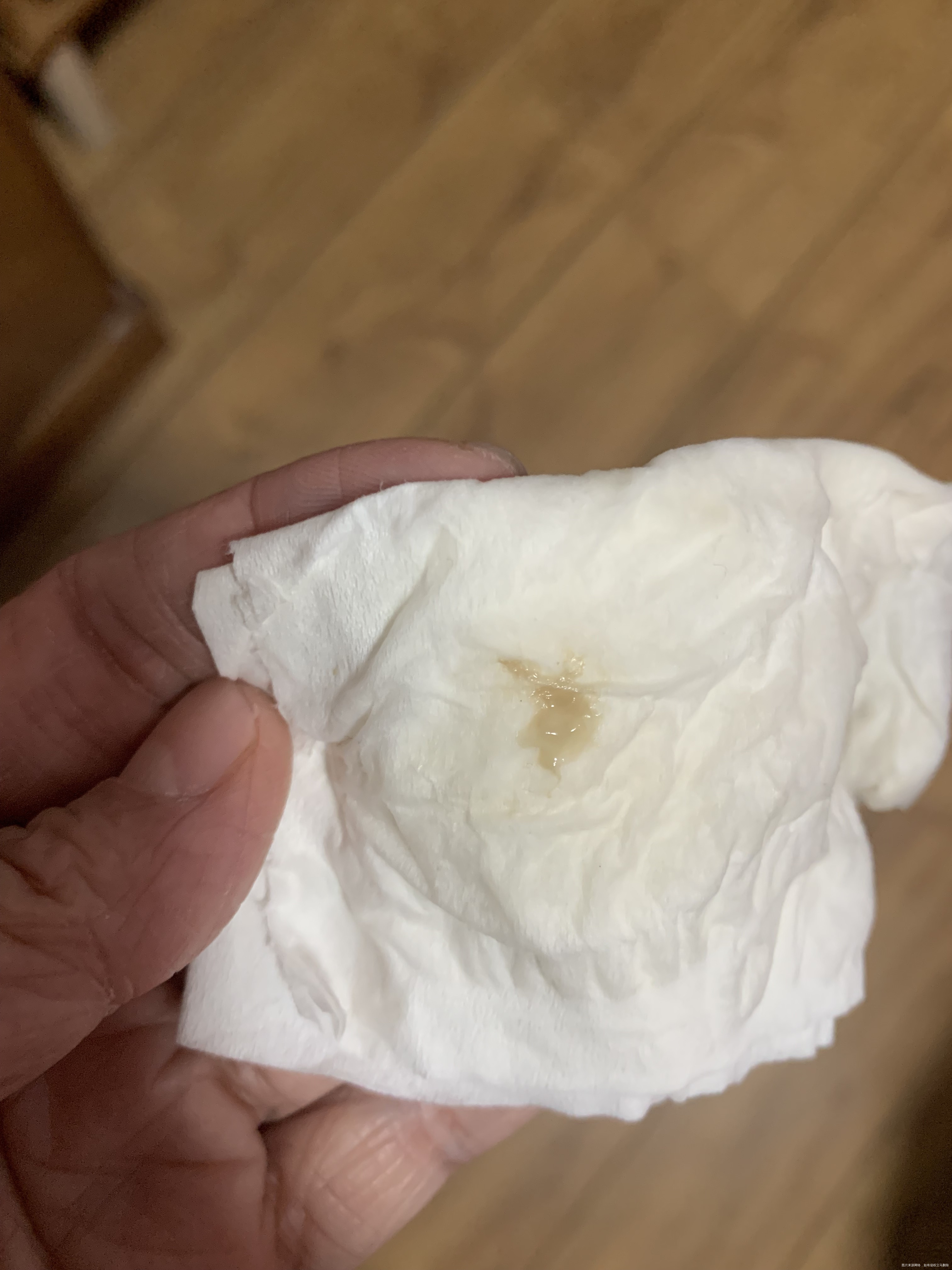 14号彩超显示见胎心今天有分泌物有点粉色会是