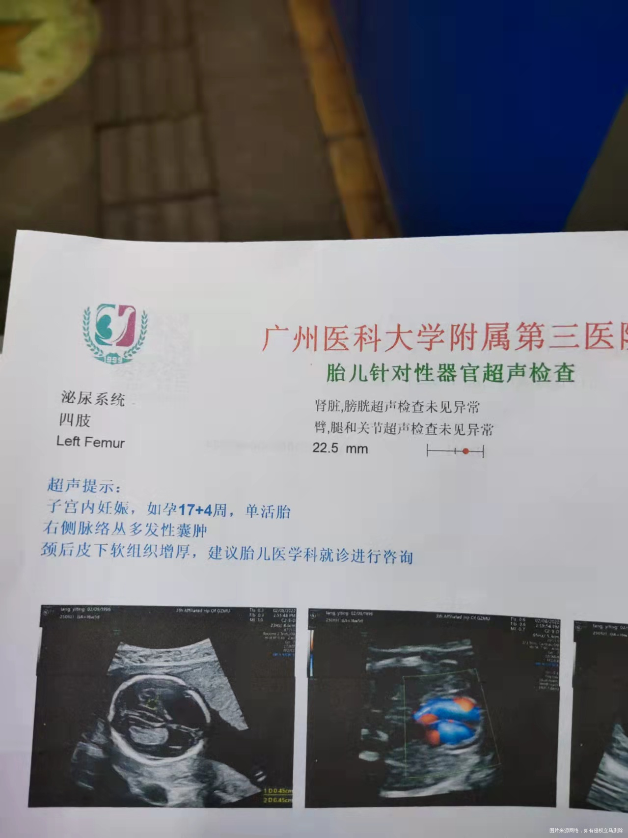 胎儿针对性器官超声检查结果出来了有点担心