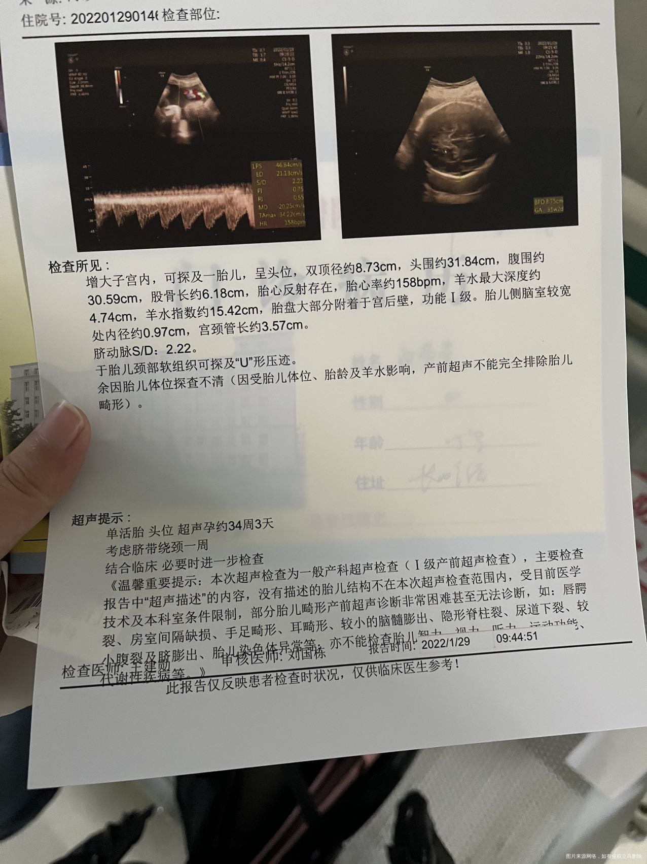 32周去复查侧脑室增宽比之前又涨了胎儿偏大两