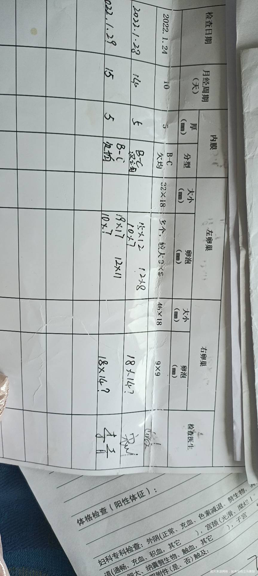 多囊月经第5天吃了氯米芬排卵期监测排卵月经推