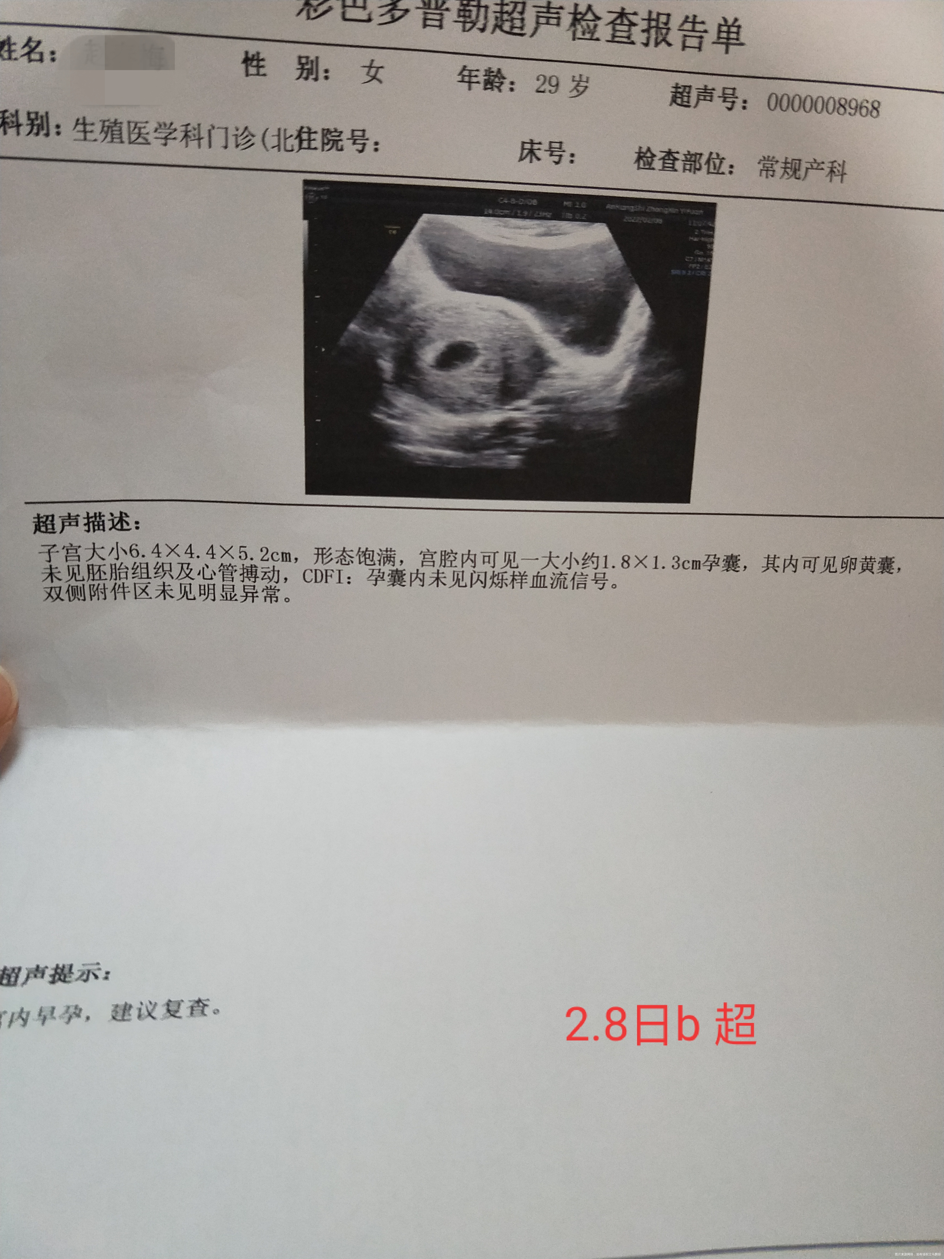 我之前有过两次生化妊娠一次稽留流产这次从刚查