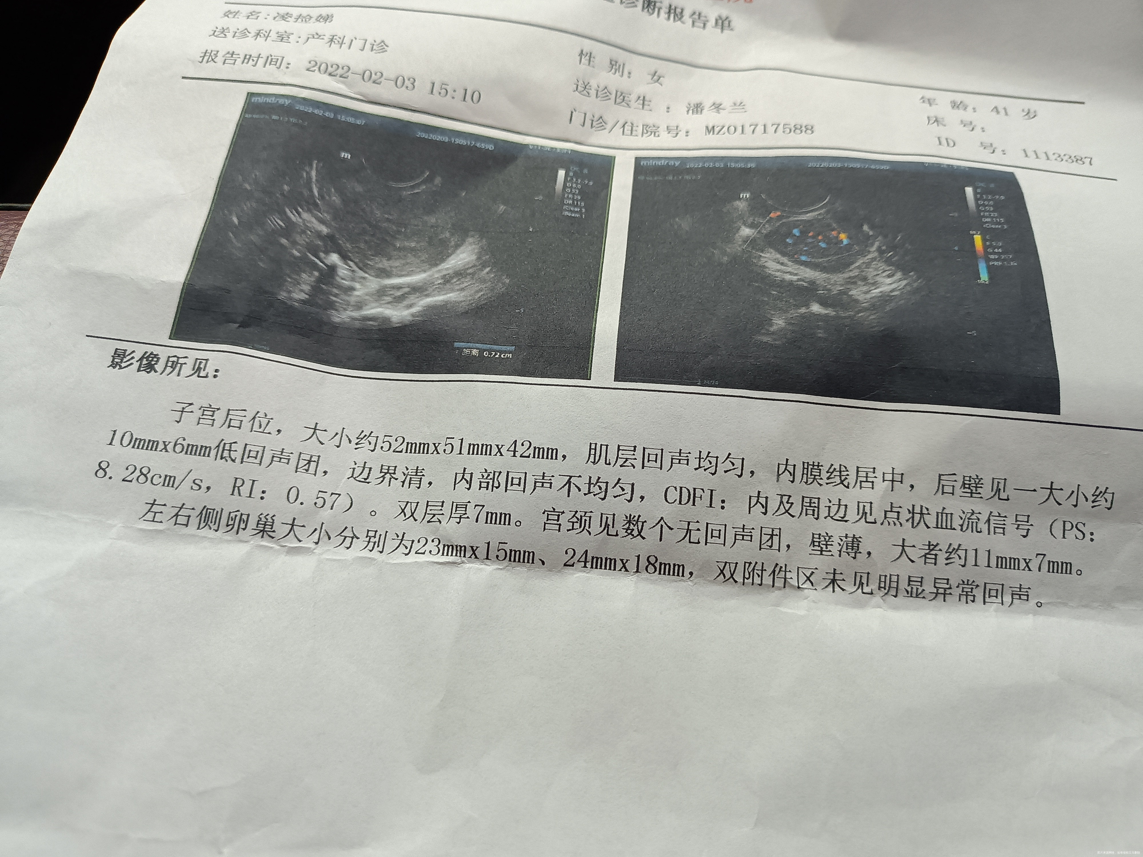 新年好我上个月做宫腔镜月经推迟25天今天做了