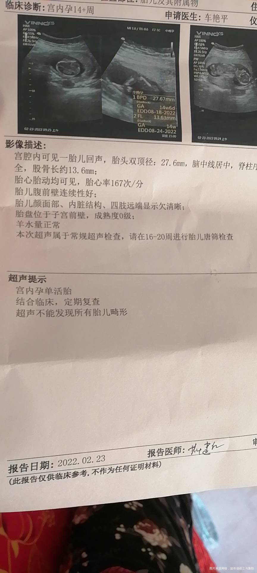 14+5麻烦看一下b超图片孩儿这个姿势咋回事