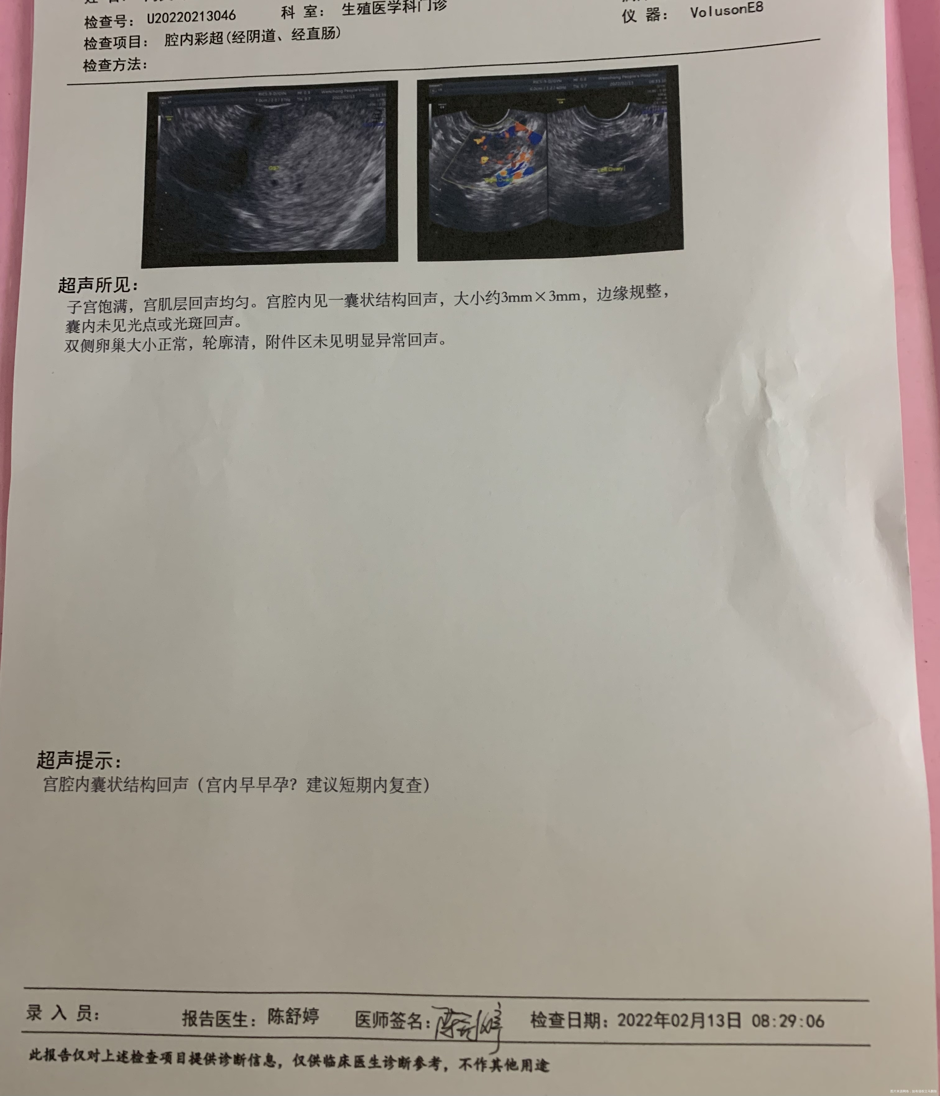 4周+5这个b超正常吗什么时候可以看到孕囊和