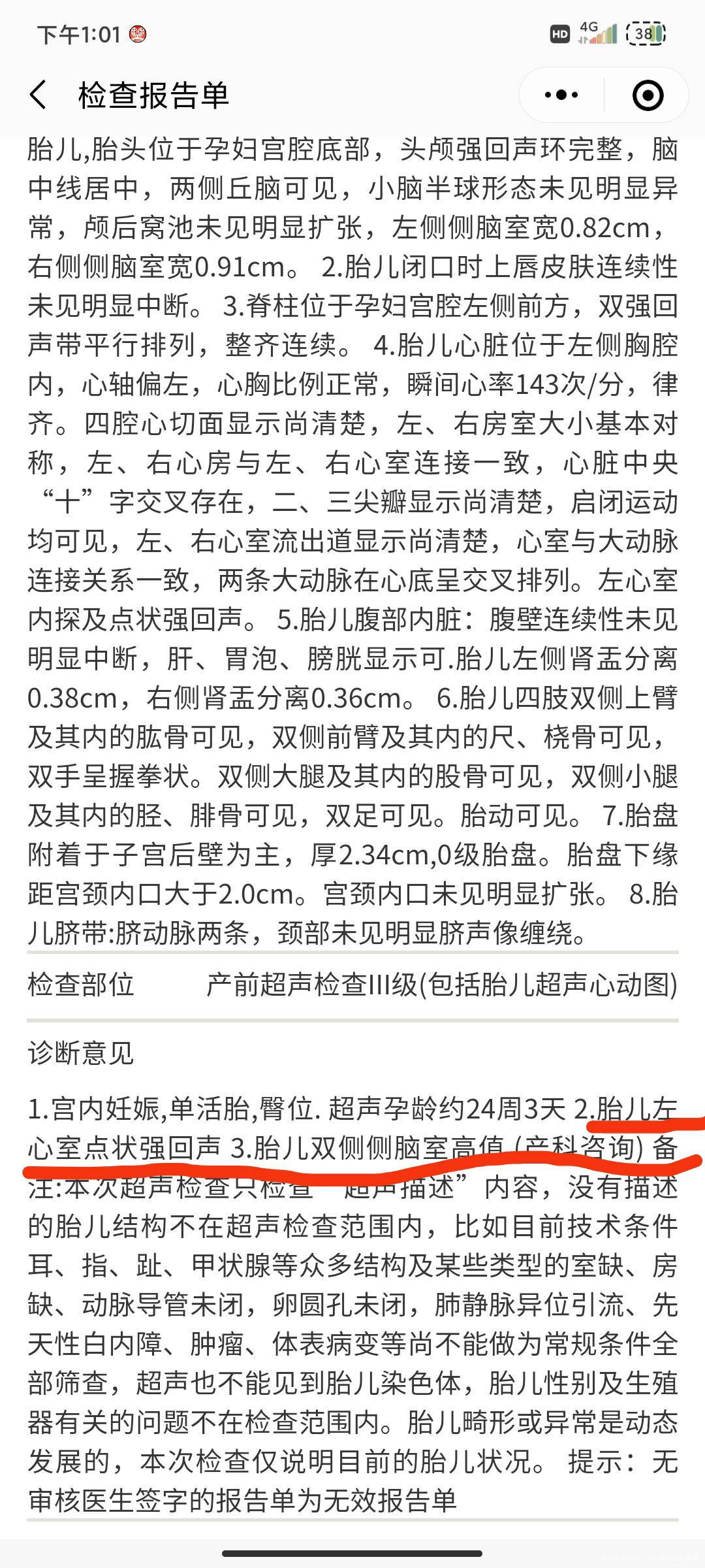 孕24+3三维B超左心室强光点左侧侧脑室08