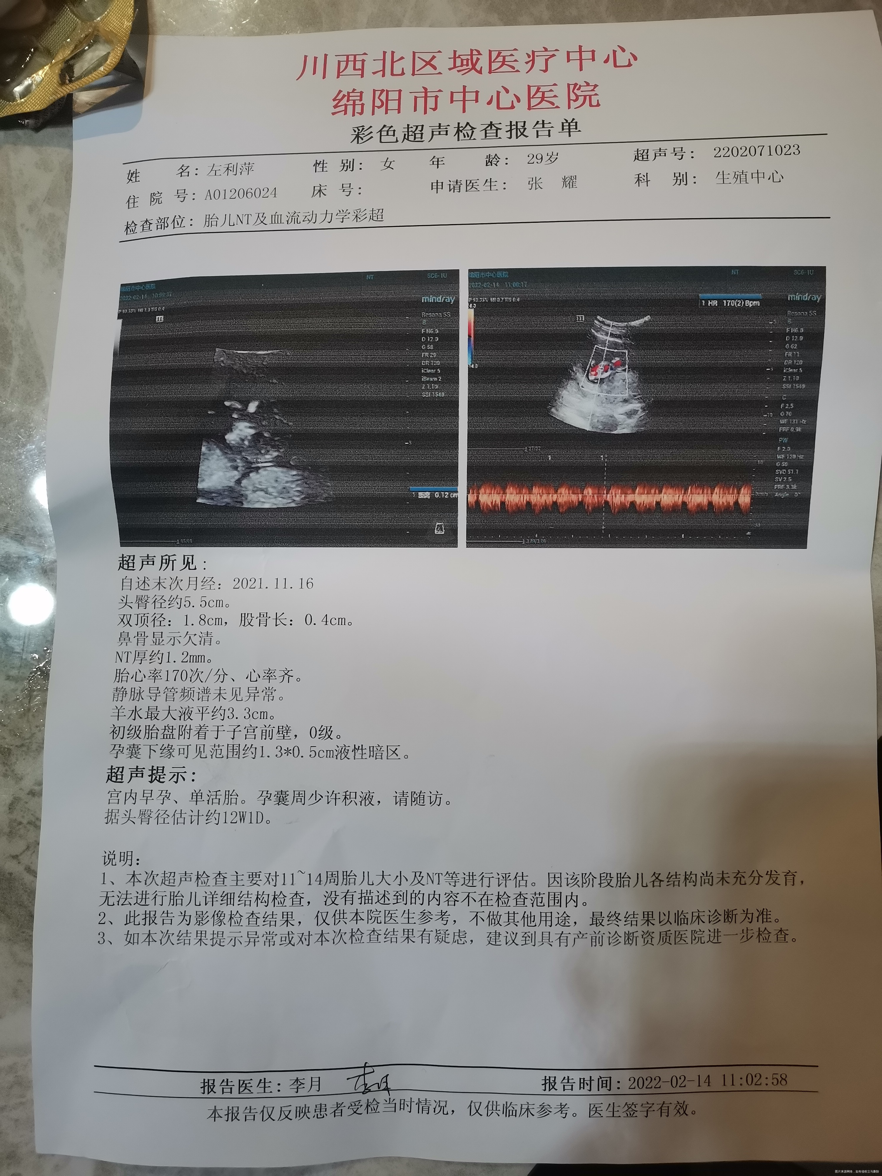 医生您好我是2021年11月16日来的末次月