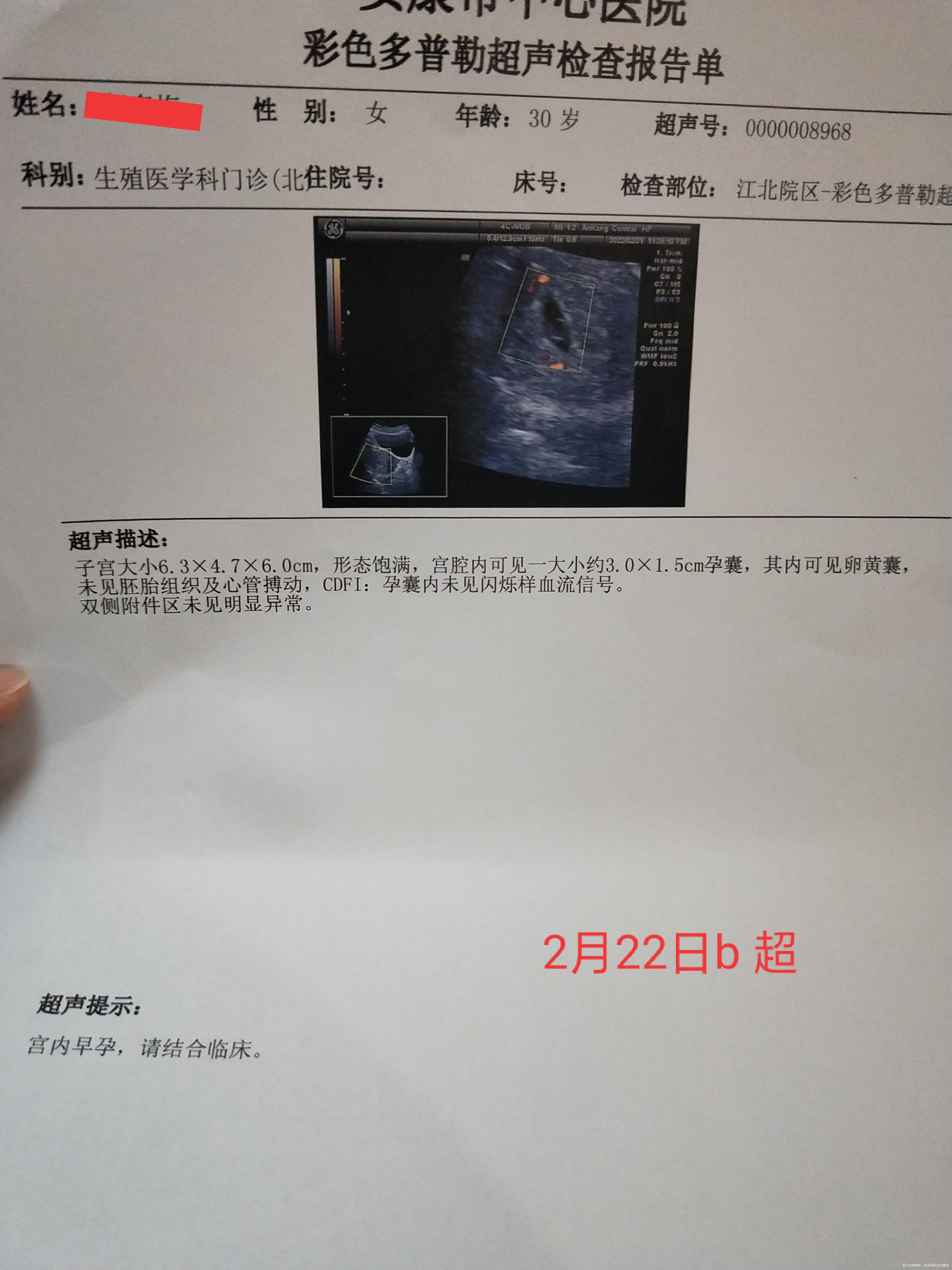 我之前有过两次生化妊娠一次稽留流产这次从刚查