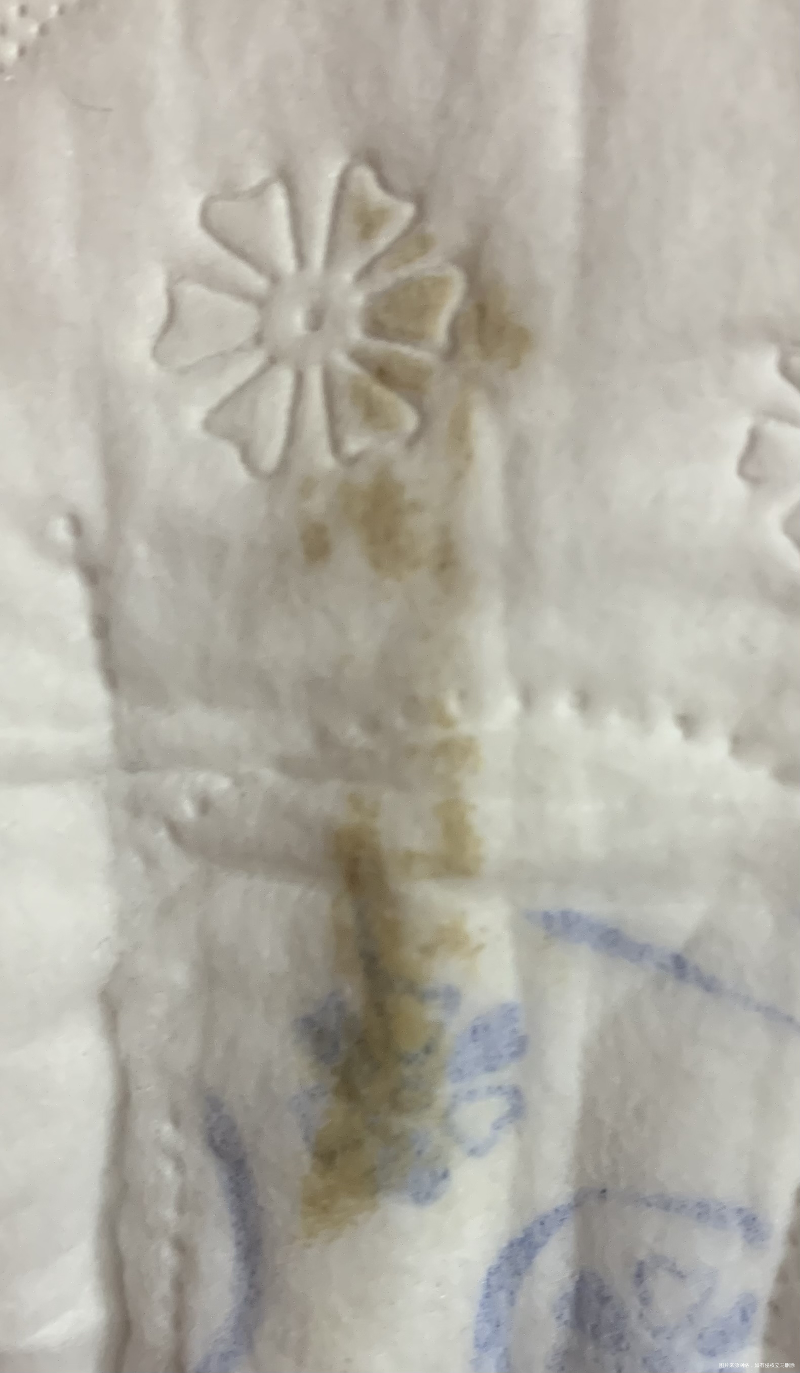 42天流褐色分泌物比下图深一点42天的时候做