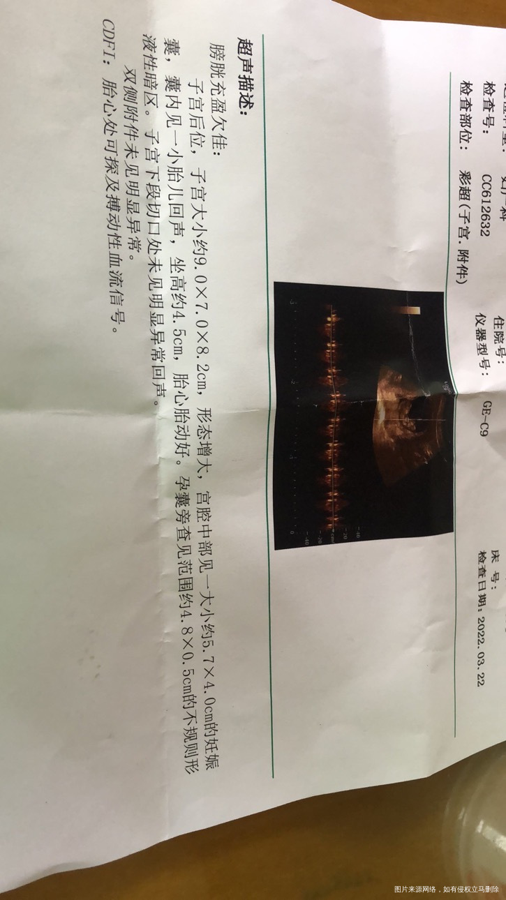 请问各位医生这值正常不