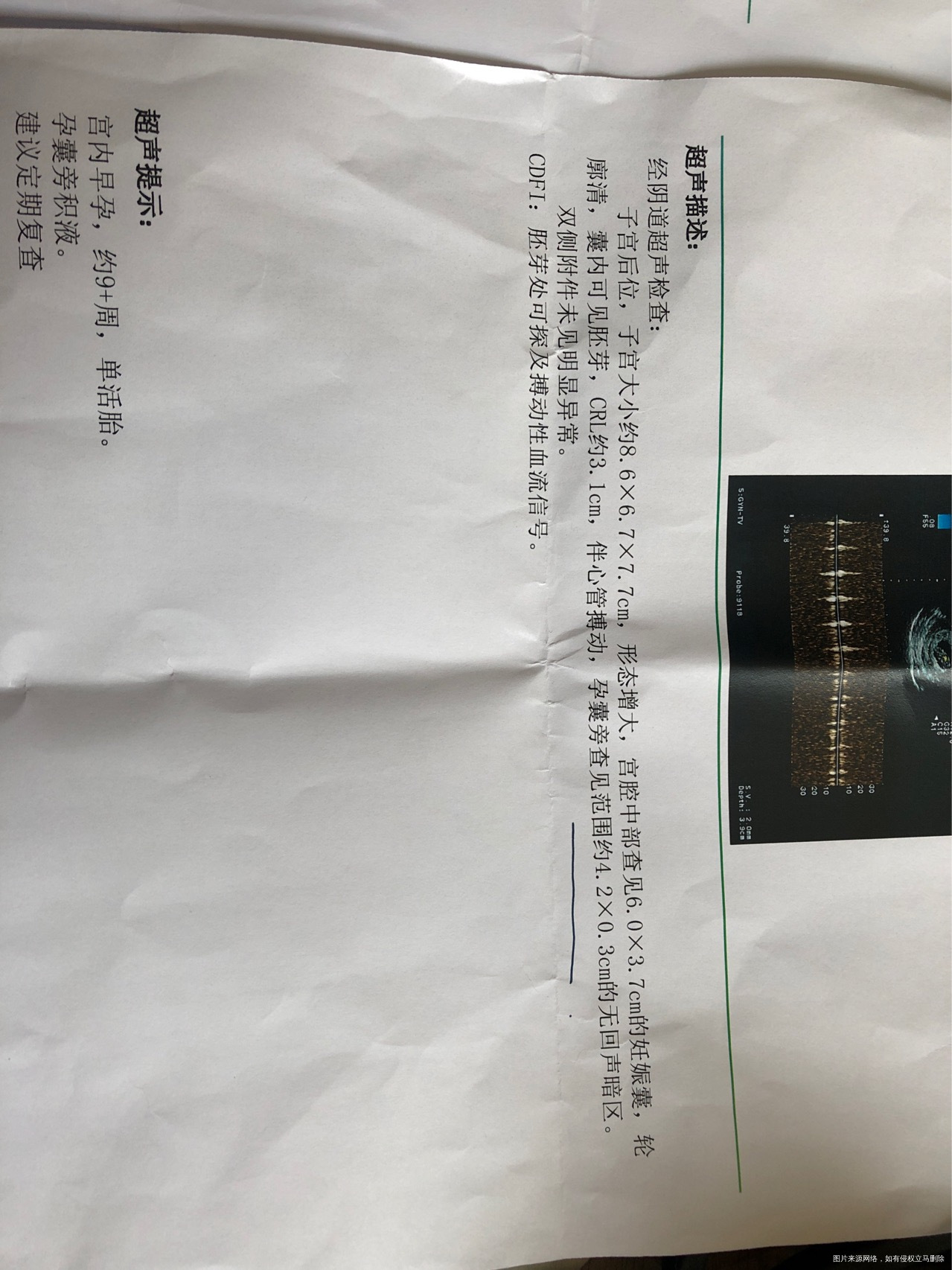 孕囊旁积液可怕吗玻璃心的我特别担心请医生们帮