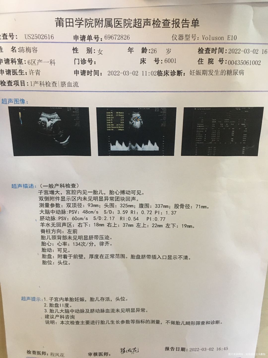 你好医生我今天39周整这是今天的彩超帮我看看