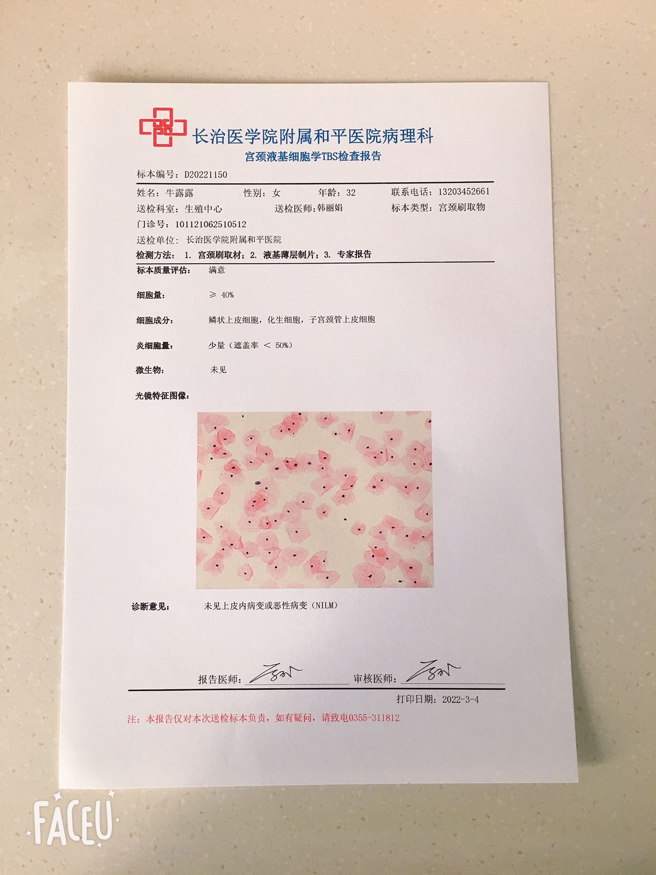 我这个hpv感染需要怎样治疗去年检查没事的今