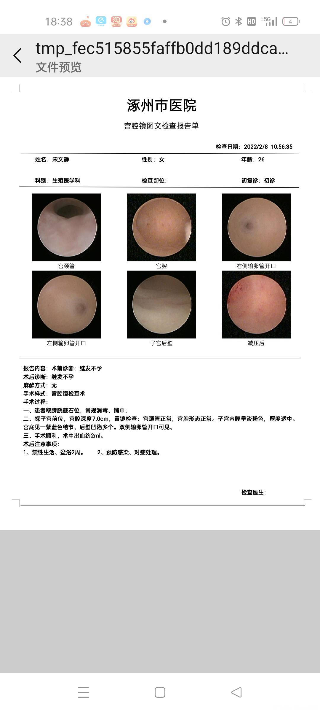 请医生给看一下这个片子有没有子宫内膜异位症的