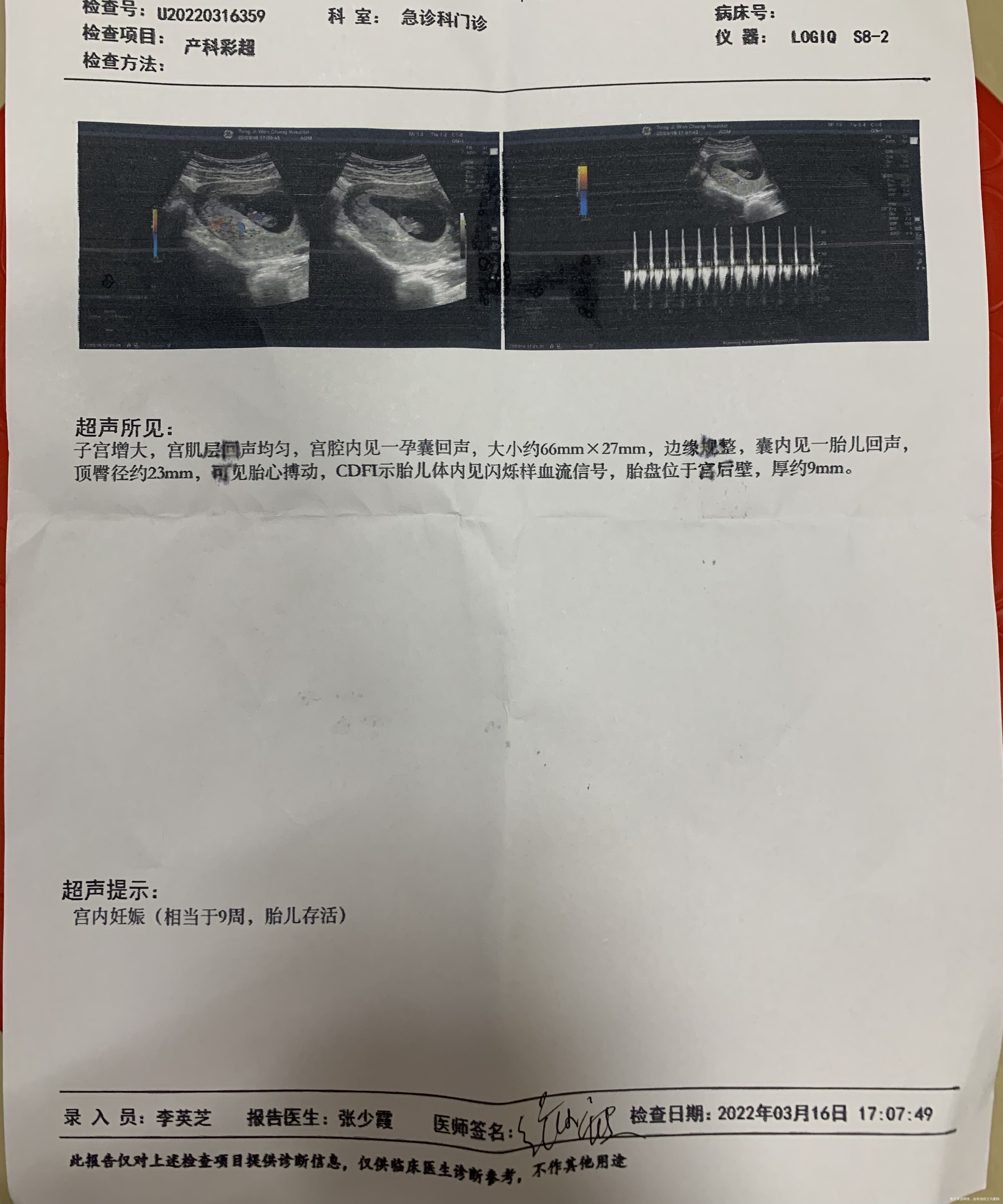 末次月经1月8号1月24号排卵帮忙看看结果
