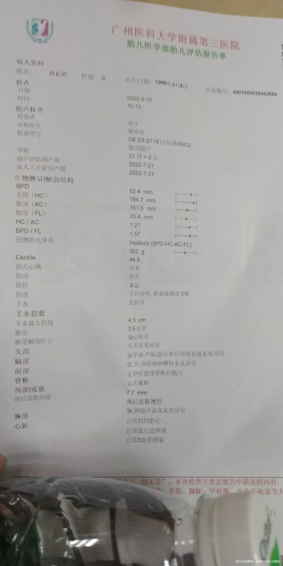 13周做Nt363341然后做了绒毛穿刺结果