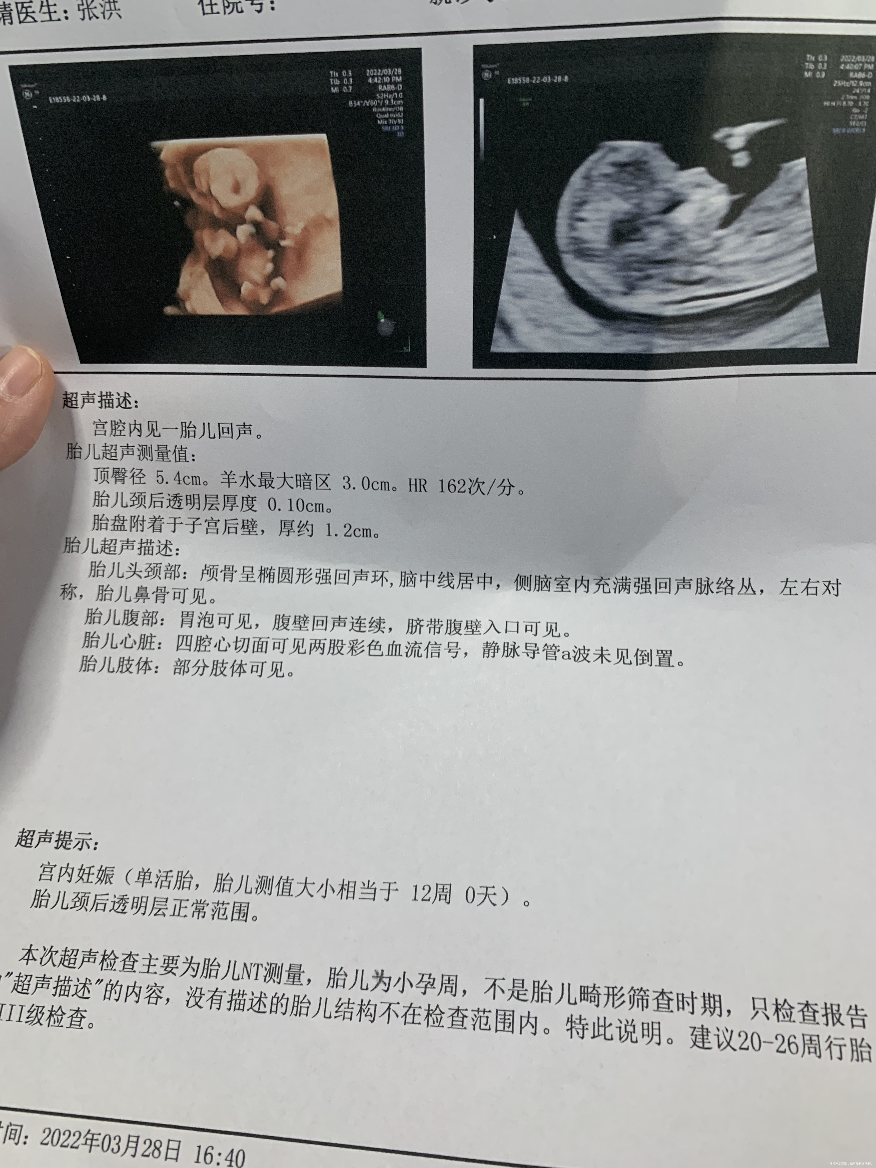 刚做了Nt帮看看有问题吗