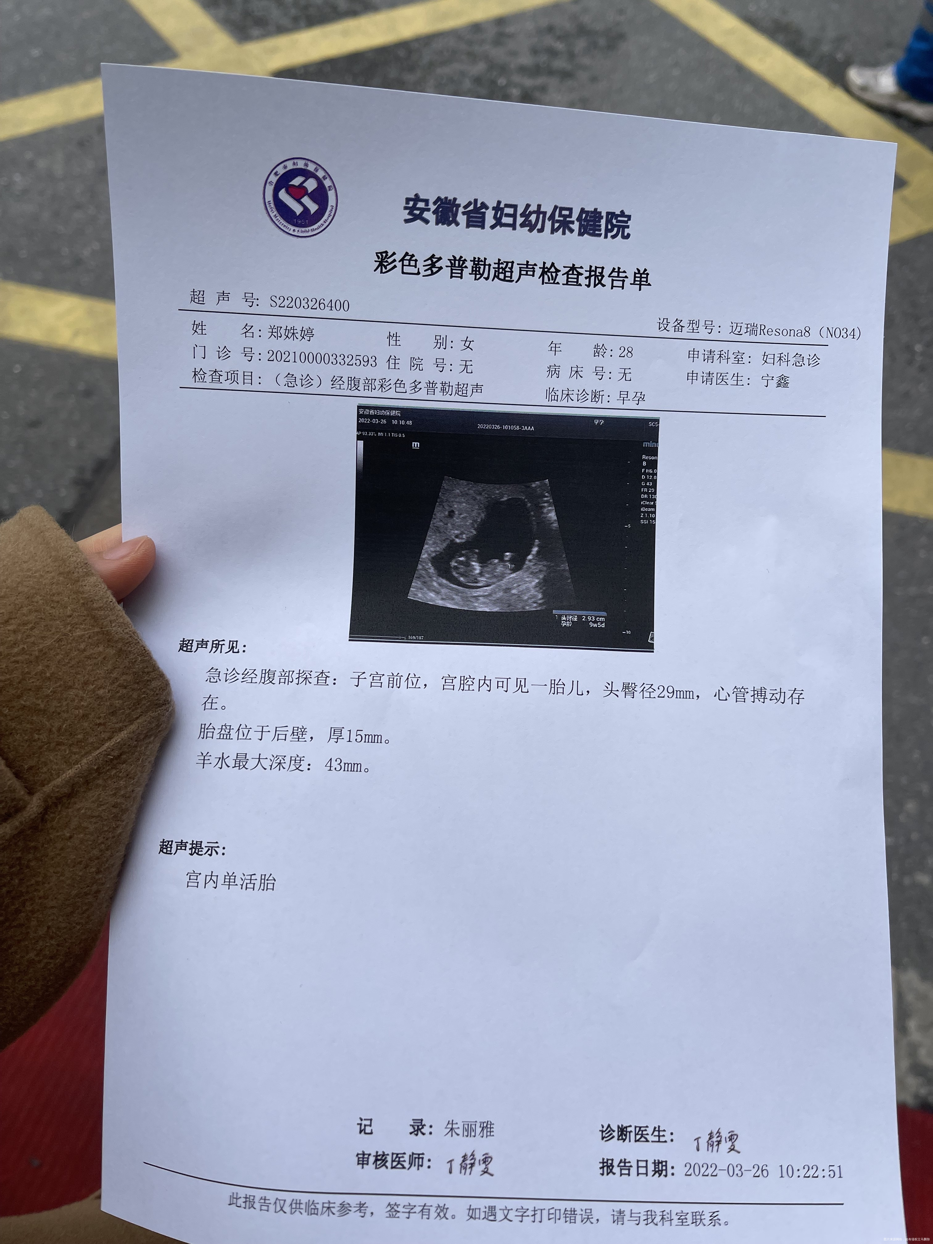 请问医生老师孕十周显示胎盘已形成是不是可以不