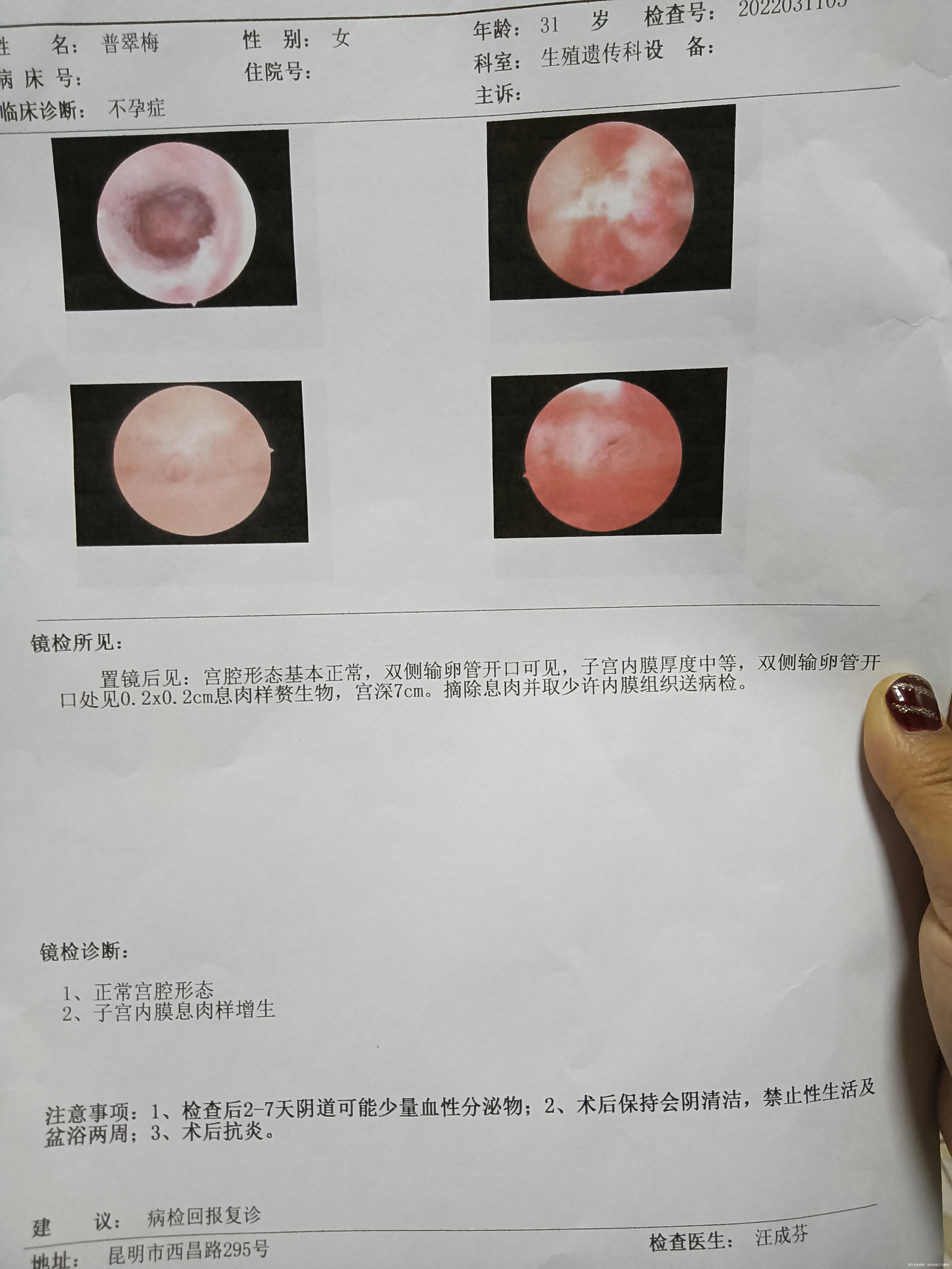 请问医生这个影响胚胎移植吗需要怎么治疗家离医