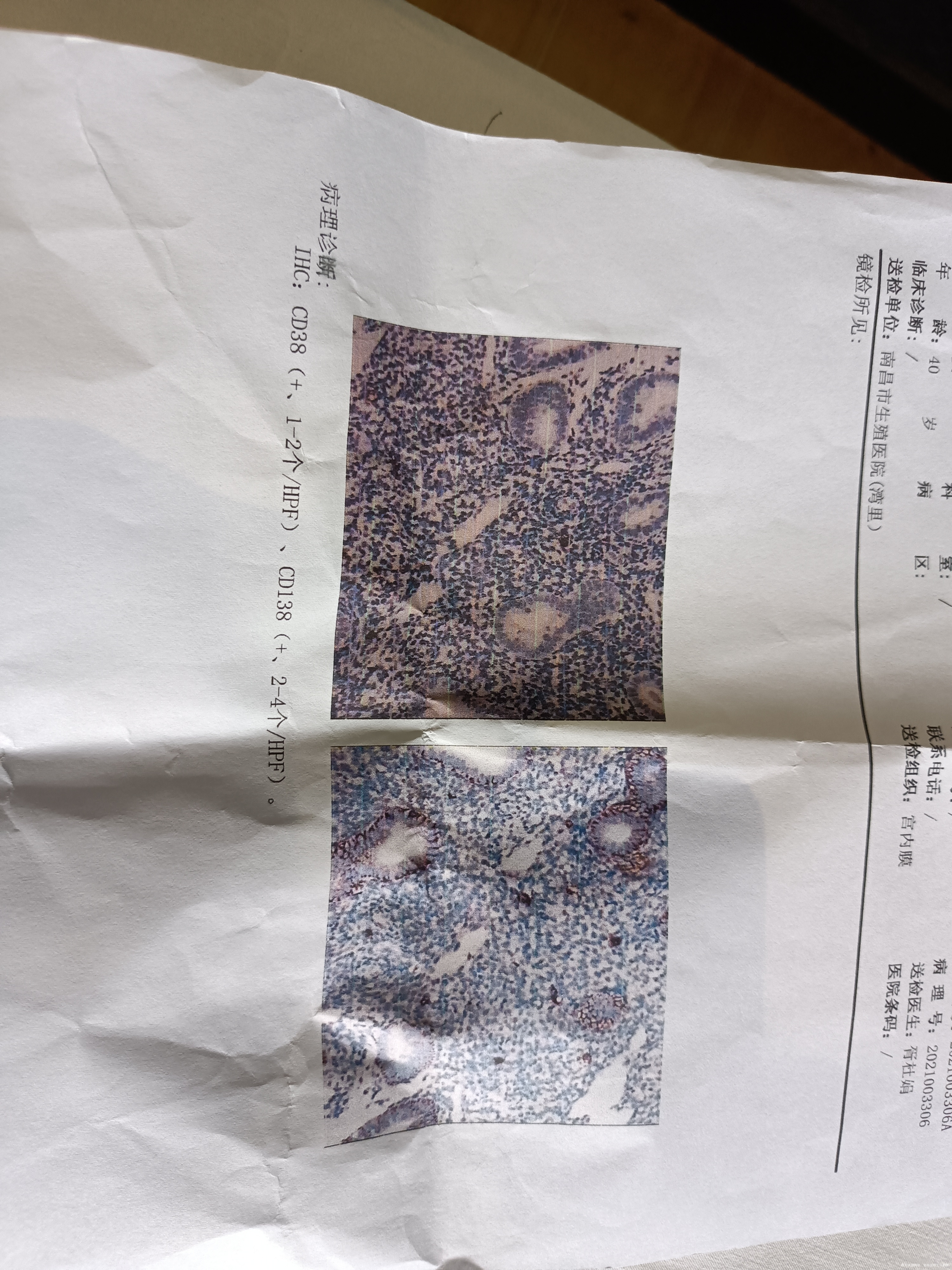 想问一下这严重吗要多久才可以好