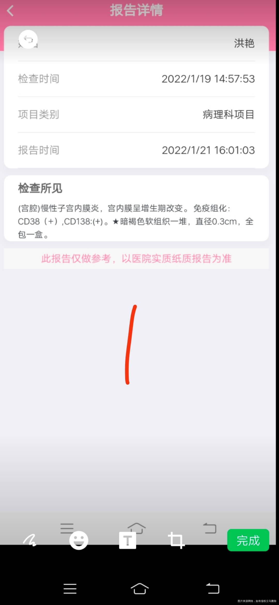 第一次宫腔镜诊刮有有炎症吃多西环素18天月经