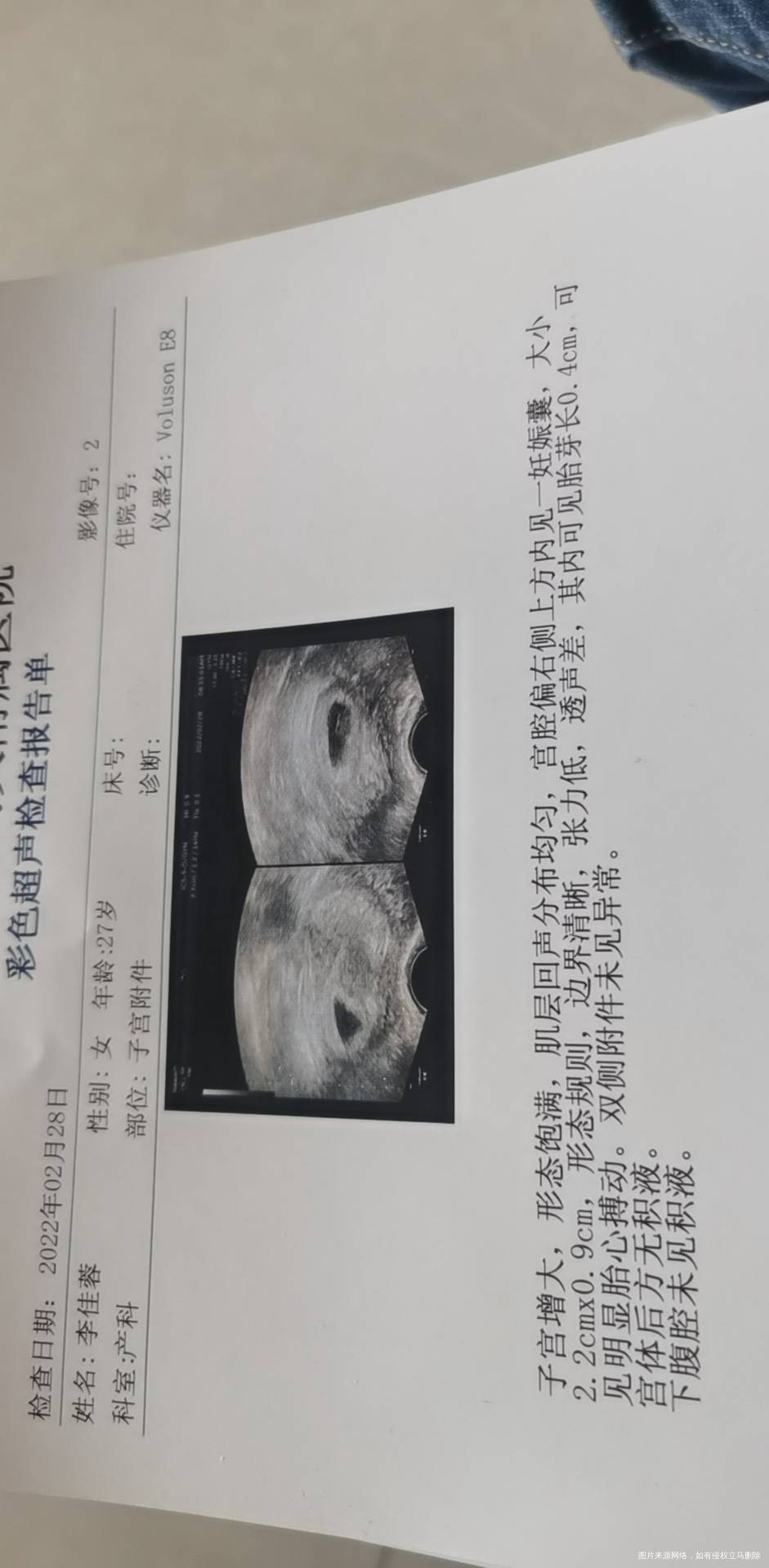 看下b超妊娠位置好不好还有张力低和透声差怎么