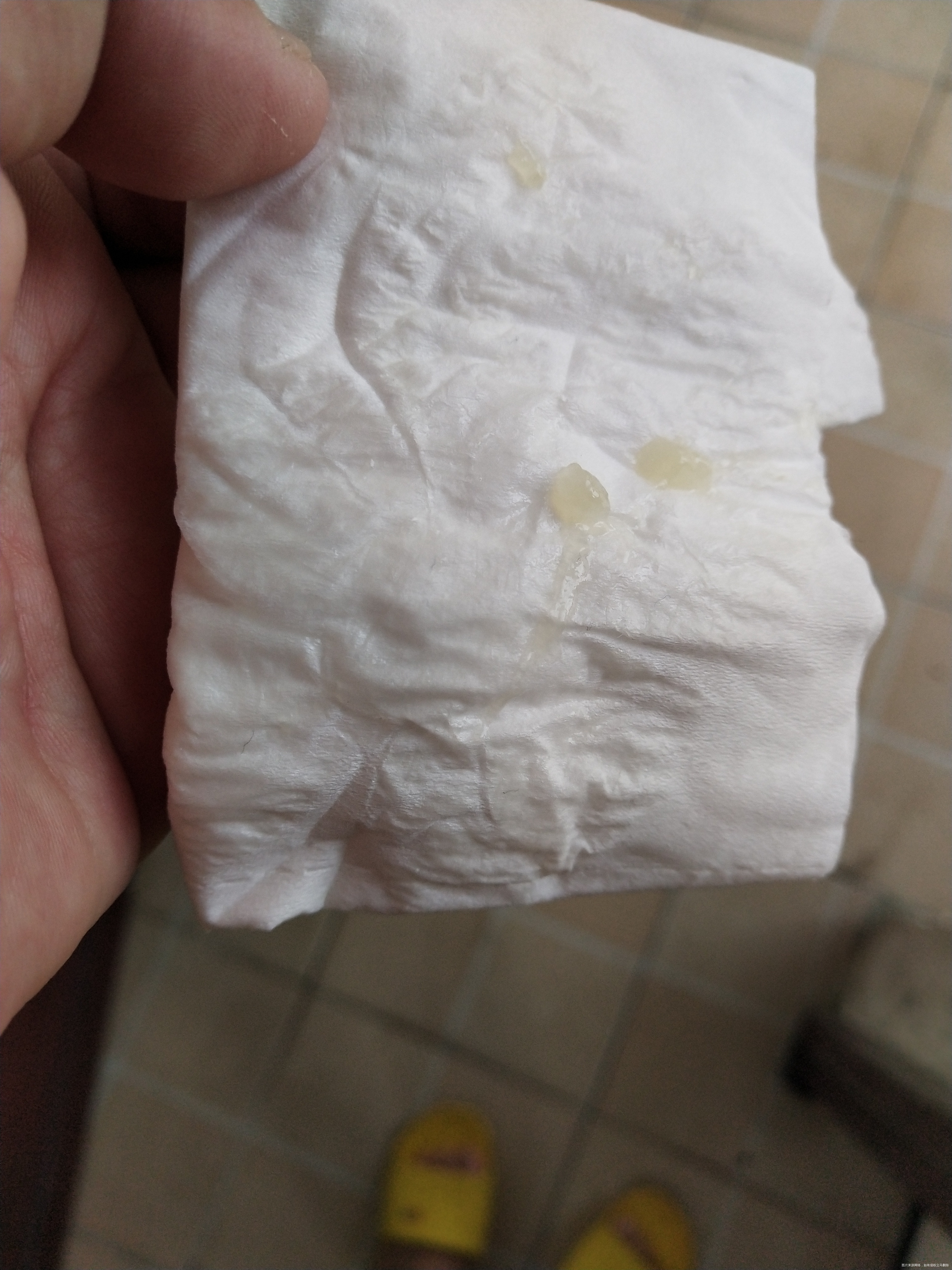 请问一下现孕35周13周做了宫颈环扎现在还没