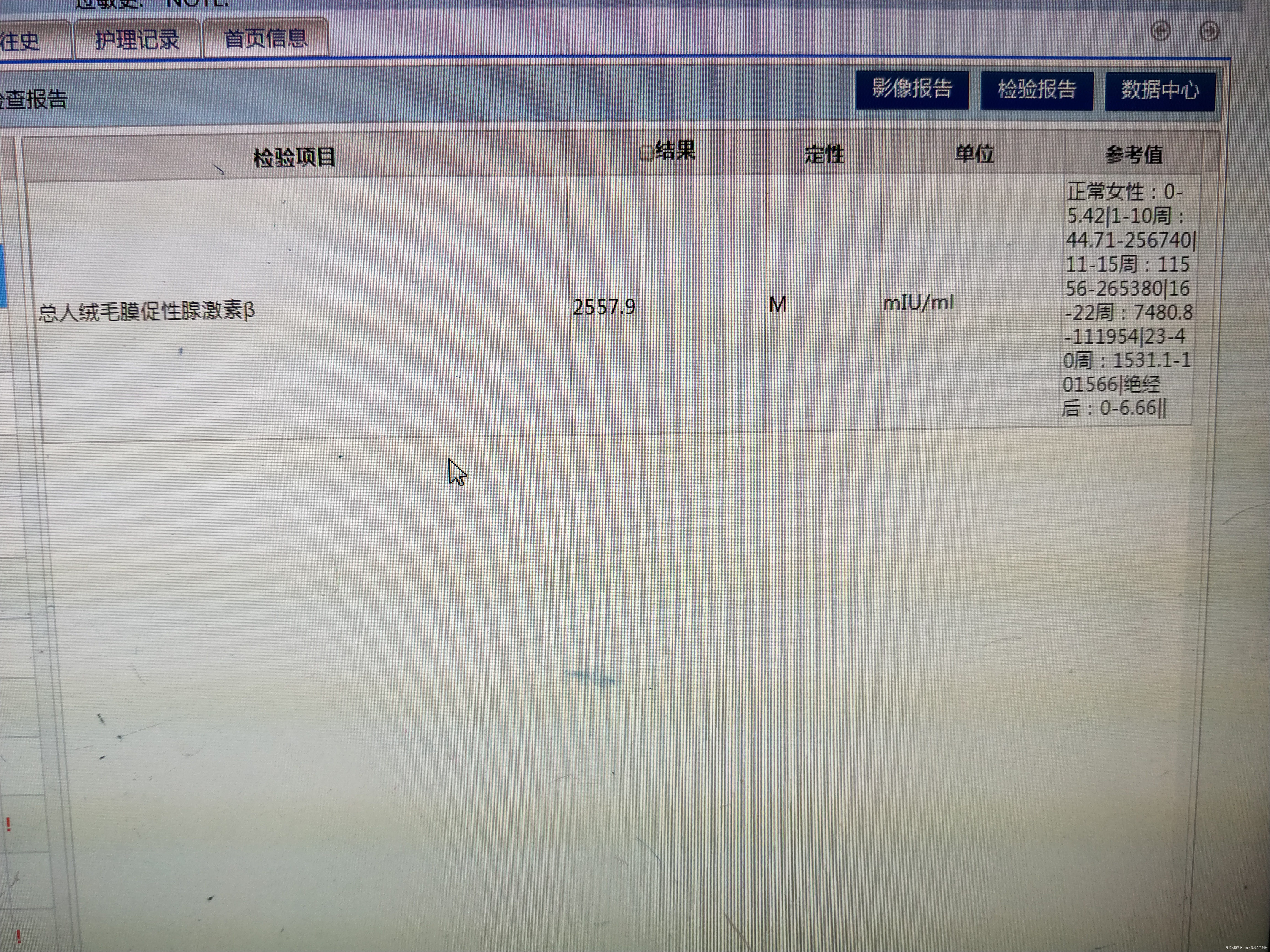 各位老师我是孕九周只有卵黄囊没有胚芽和胎心入