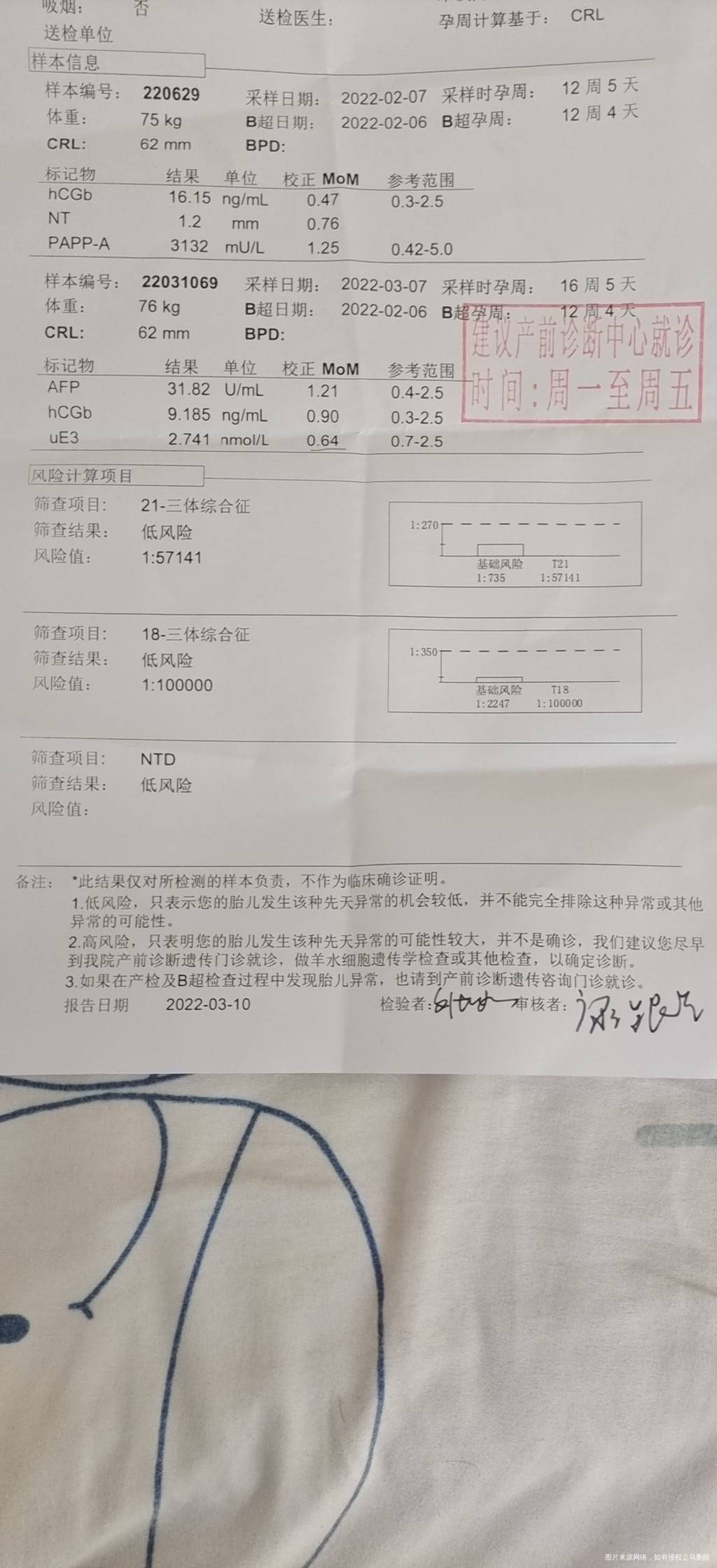 这个数据正常吗uE3数值偏低本次数值是064