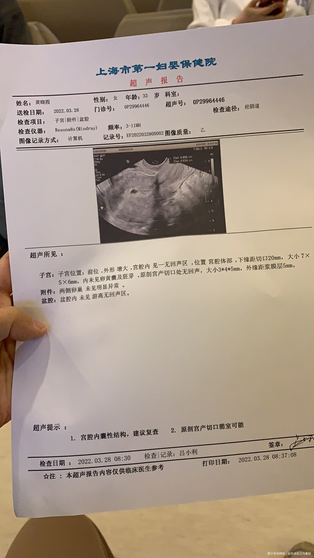 医生你好帮我看下我是310号移植的冻囊胚一个