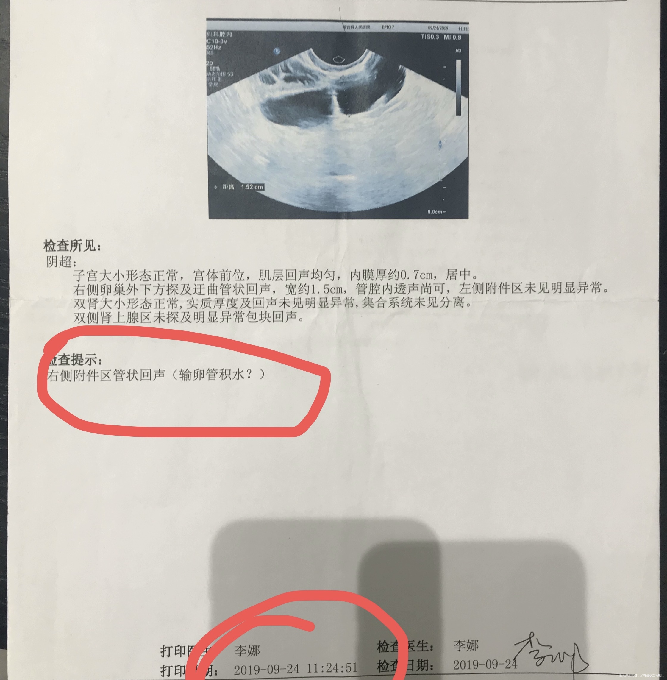 除了再做一次造影外还有其他的检查建议吗