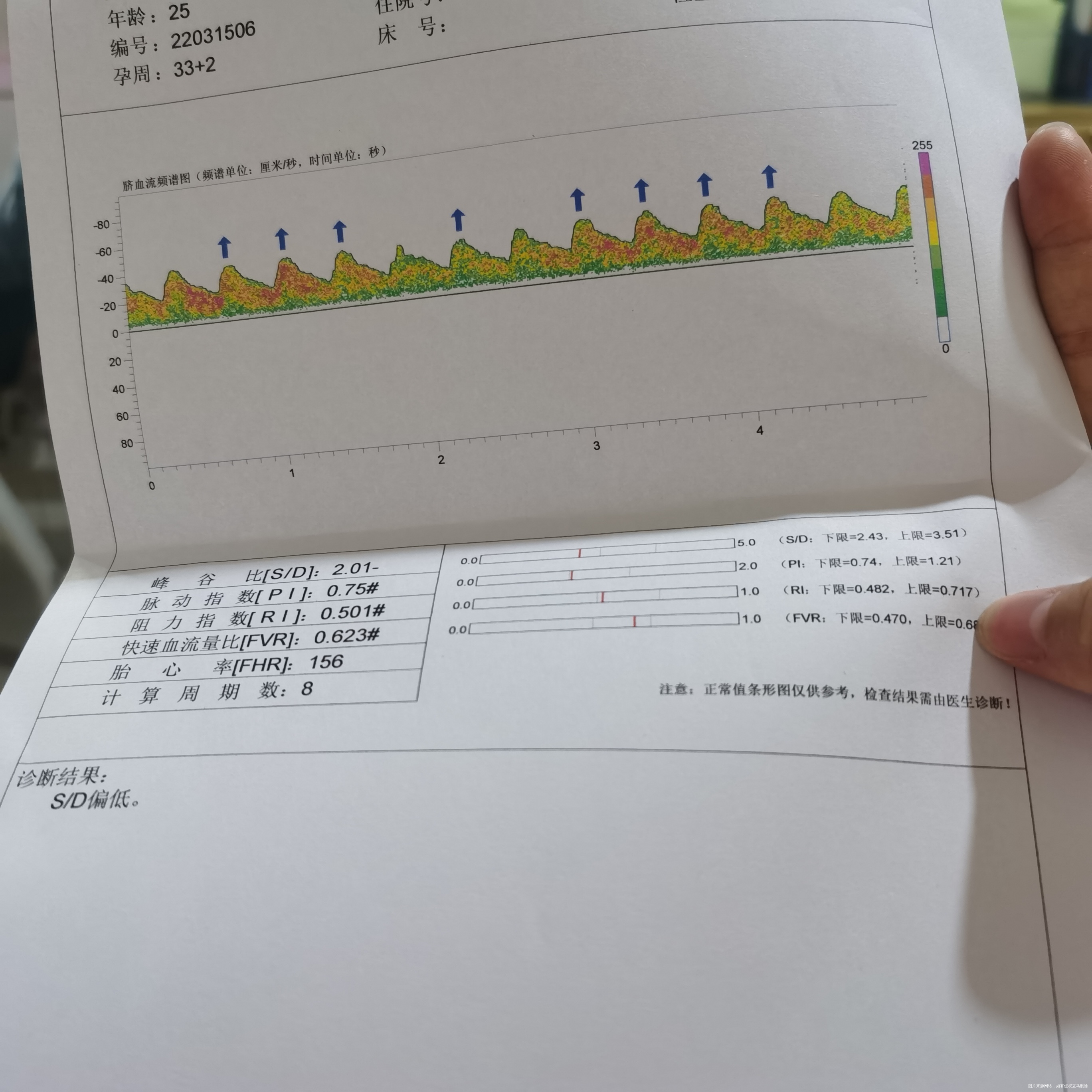 你好SD偏低有影响吗