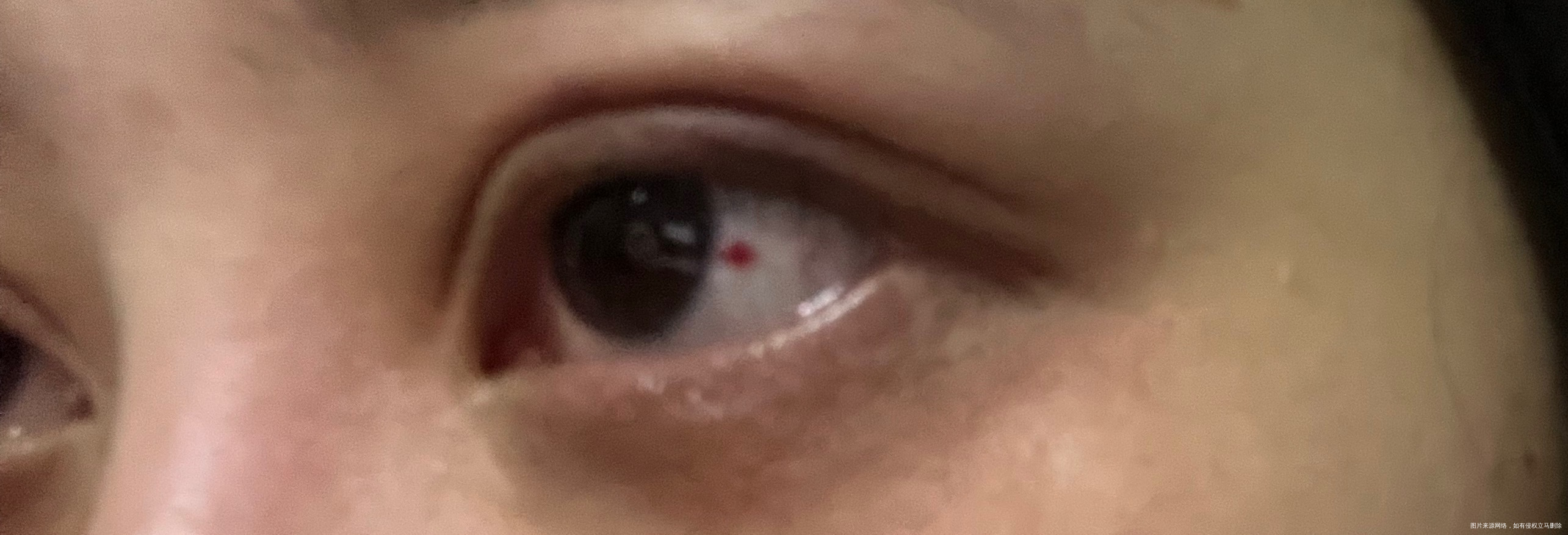 前几天没感觉今天起床眼球有点疼