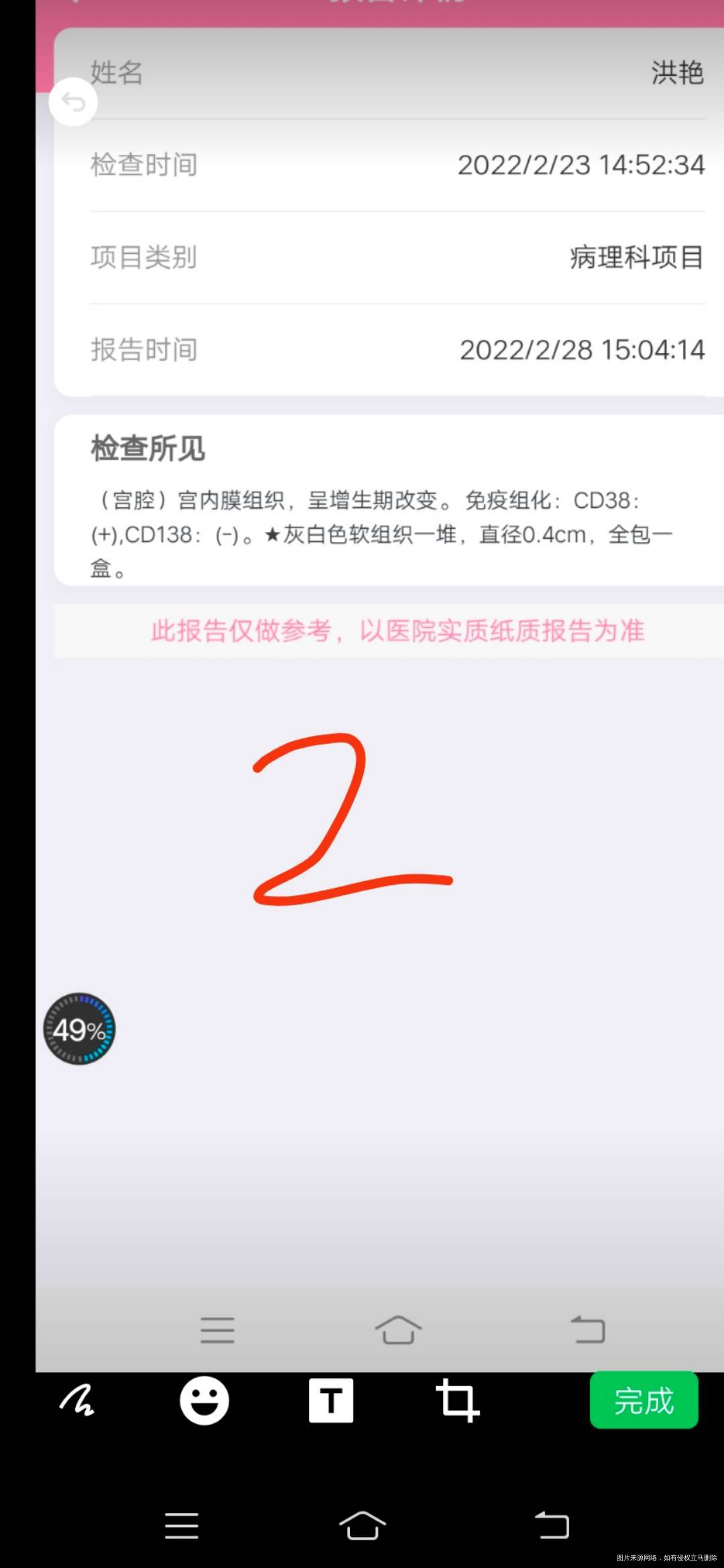 第一次宫腔镜诊刮有有炎症吃多西环素18天月经