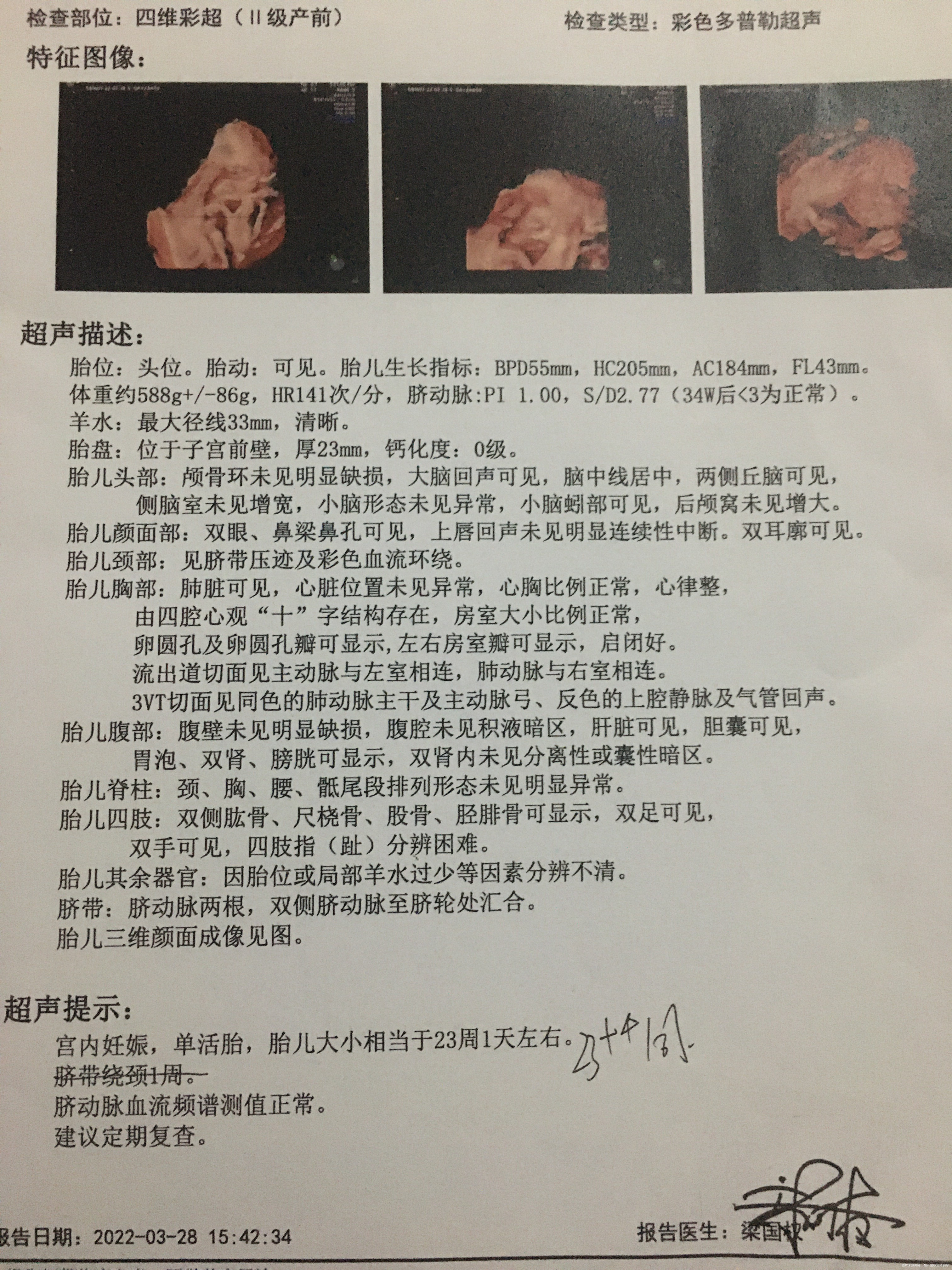 医生您好这个是今天检查的四维彩超报告请问这个
