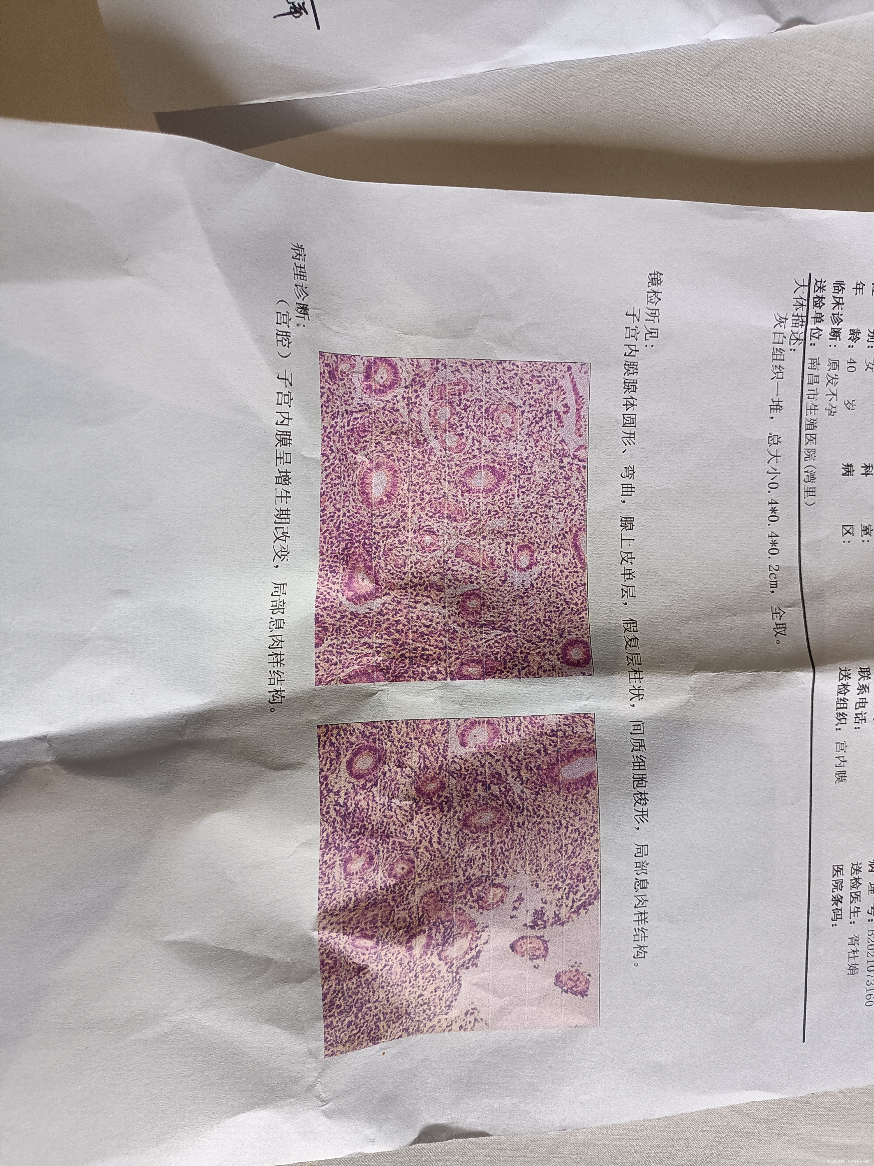 想问一下这严重吗要多久才可以好