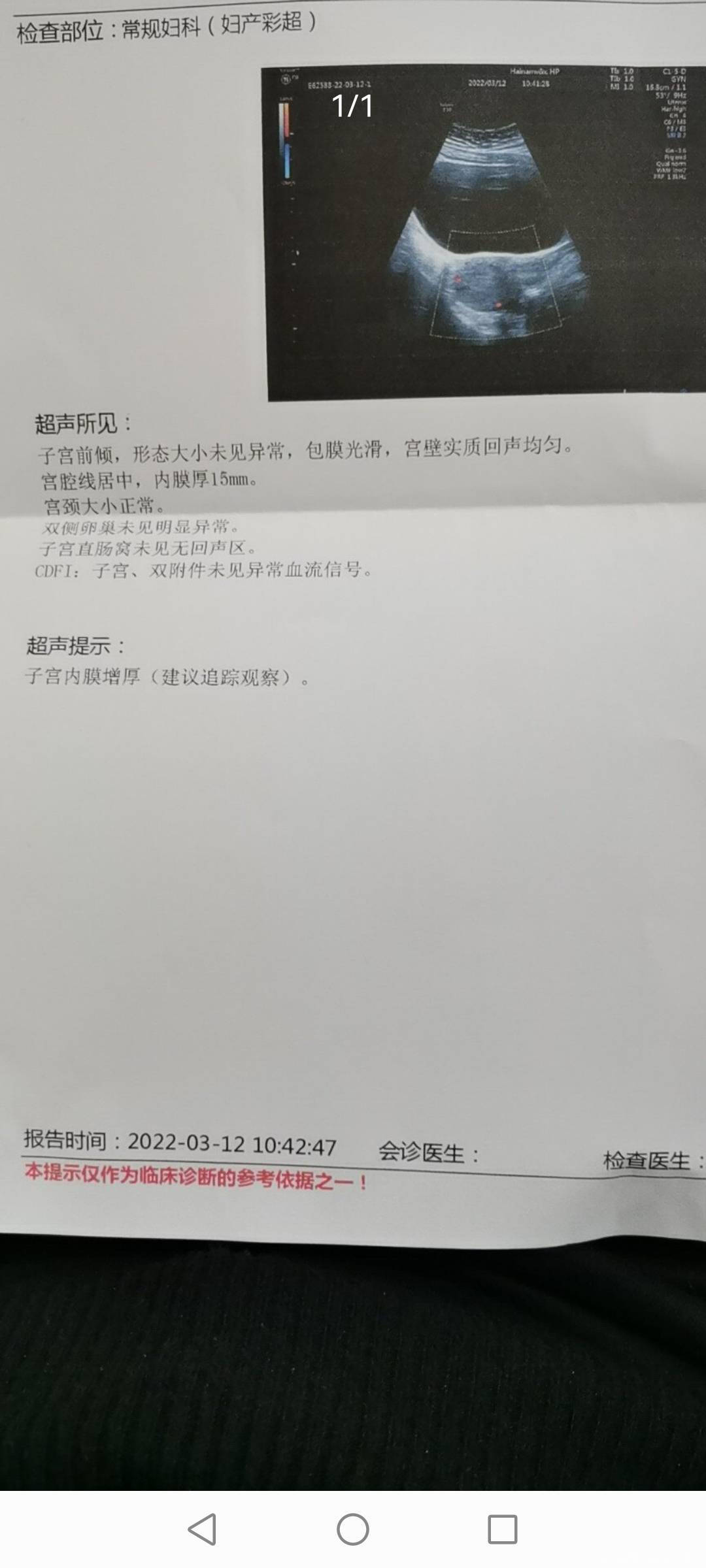 末次月经2月5日今天去照腹部B超没有看到孕囊