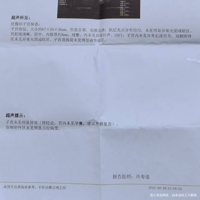 请问一下子宫内膜正常吗谢谢