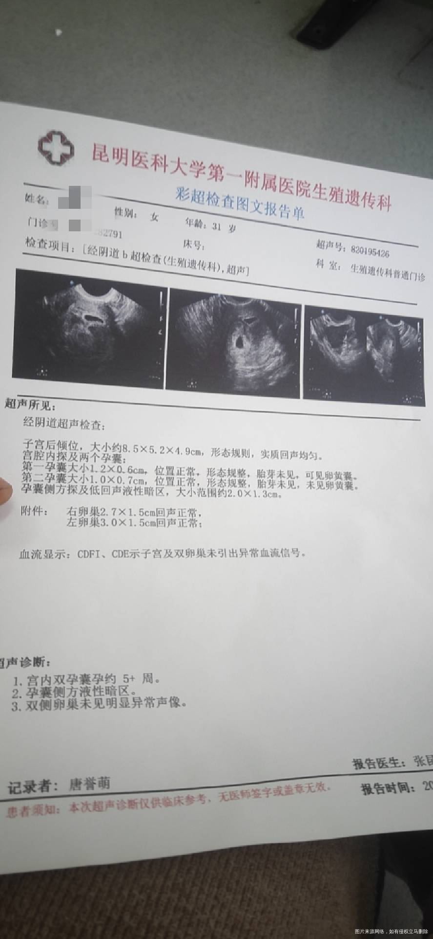 昨天是移植后第十八天早上5点多开始大出血到9