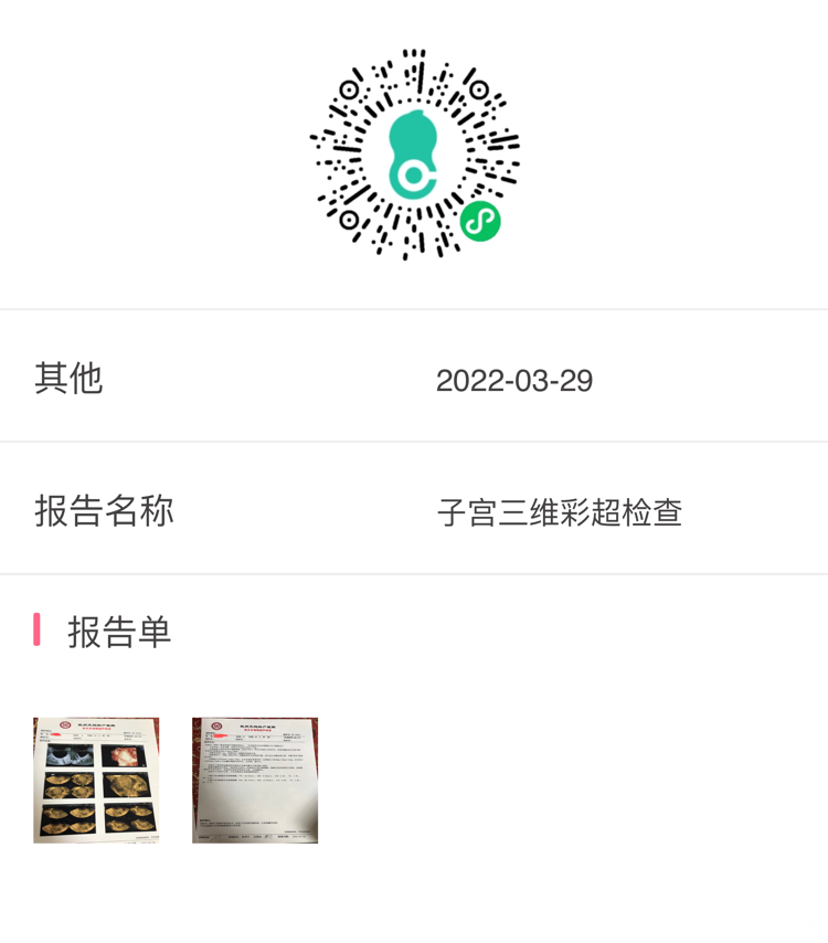 医生您好麻烦您帮我看下我18周+5引产后子宫