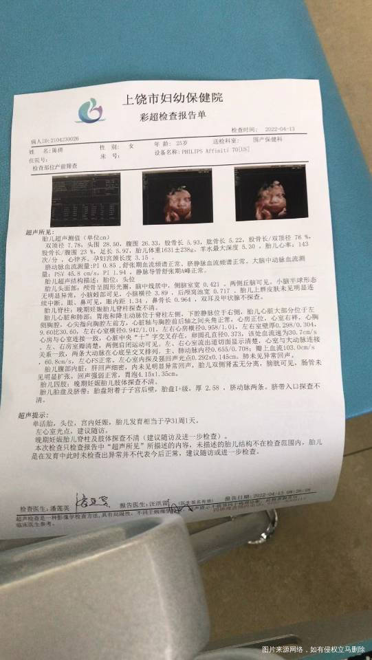 医生能帮我看看宝宝有个强光点是什么原因有什么