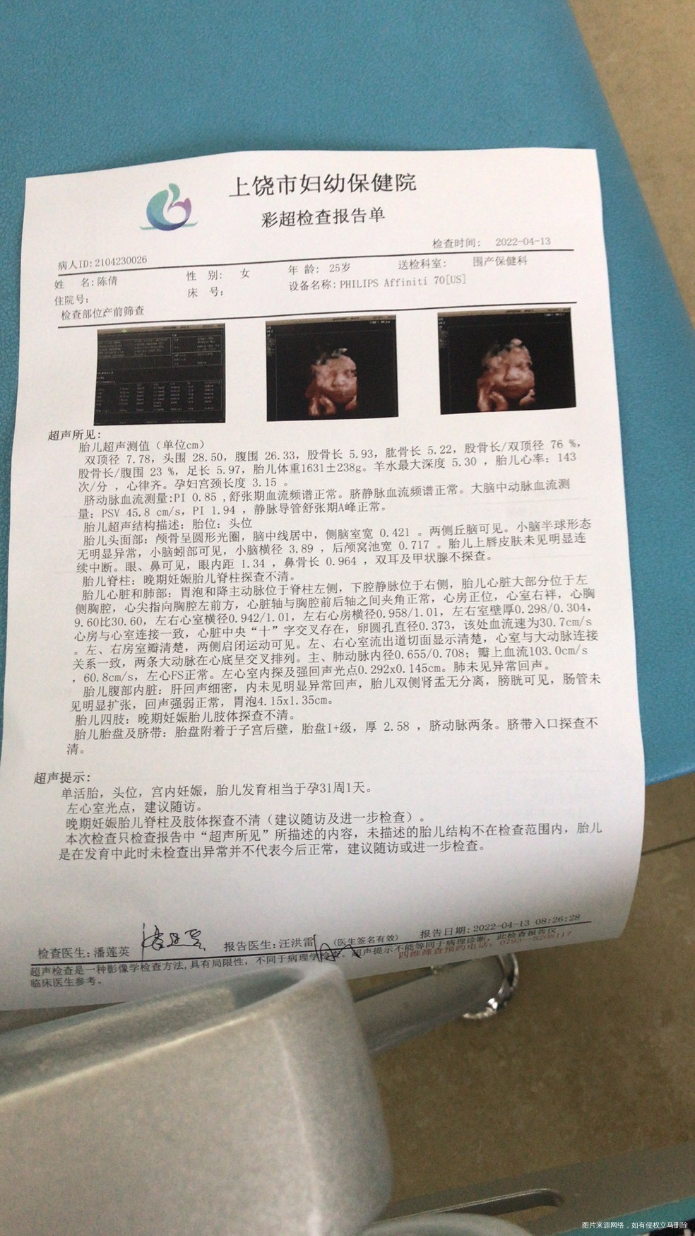 医生能帮我看看宝宝有多少斤吗