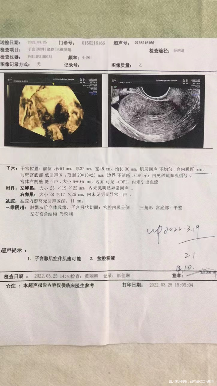 医生您好麻烦帮我看下报告超声提示腺肌症和肌瘤